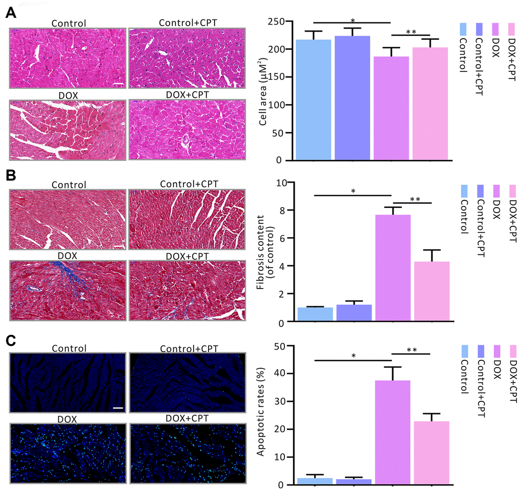 Cryptotanshinone (CPT) gavage attenuated myocardial fibrosis and apoptosis in rats treated with doxorubicin. Hematoxylin and eosin staining for paraffin section (A). Masson’s trichrome staining for fibrosis (B). TUNEL assay for apoptotic cardiac cells (C). Values are expressed as mean ± standard error of the mean. *P#P