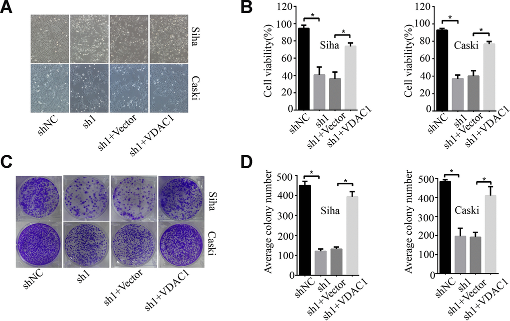 KMT2A regulated cervical cancer cell proliferation and colony formation by targeting VDAC1. Human cervical cancer Siha and Caski cells were transfected with KMT2A shRNAs or KMT2A shRNA + VDAC1 overexpression plasmid. At 48 hours after transfection, the cell viability, colony formation and migration ability were measured. (A) Viable Siha and Caski cells. (B) The average cell viability %. (C) Colony formation of Siha and Caski cells. (D) The average count numbers.