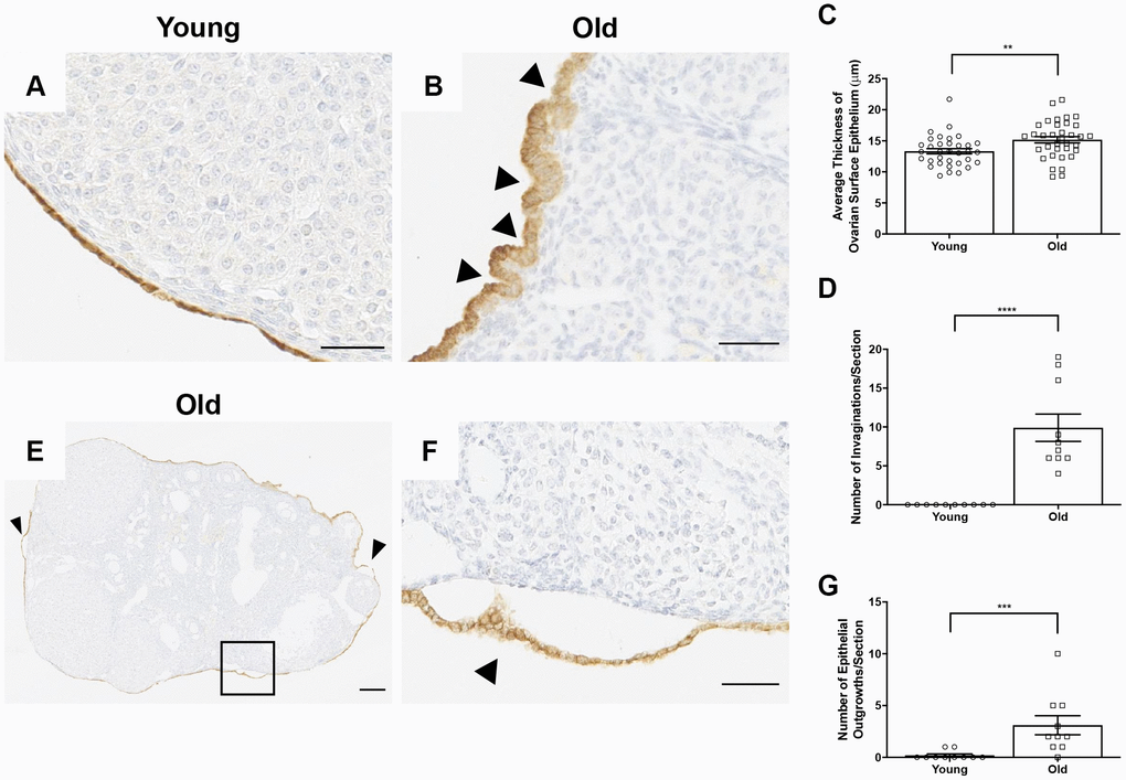 The OSE exhibits aberrant morphologies in reproductively old ovaries. (A) Representative 40X image of the OSE in an ovary from a reproductively young mouse. (B) Representative 40X image of the OSE in an ovary from a reproductively old mouse. Arrowheads indicate invaginations of the OSE into the ovarian stroma. (C) Graph showing the average thickness of the OSE for all reproductively young and old mice. N = 10 ovaries per age group, each ovary was analyzed in triplicate or quadruplicate (N = 34 measurements for reproductively young ovaries, N = 35 measurements for reproductively old ovaries). (D) The graph shows the number of invaginations per ovary section for all mice. N = 10 ovaries per age group. (E) Representative image of an aged ovary. Arrowheads indicate epithelial growths. (F) High magnification region of the boxed region in (E) depicting an epithelial outgrowth. (G) The graph shows the mean number of epithelial outgrowths per ovary section for all mice. N = 10 ovaries per age group. T-tests were performed on all measured parameters with asterisks indicating significant differences (C: P = 0.007; D: P E: P = 0.0007). Scale bars are (A, B, F) 50 μm and (E) 200 μm. Data are represented as mean ± SEM (C, D, G). N = 10 ovaries per age group.