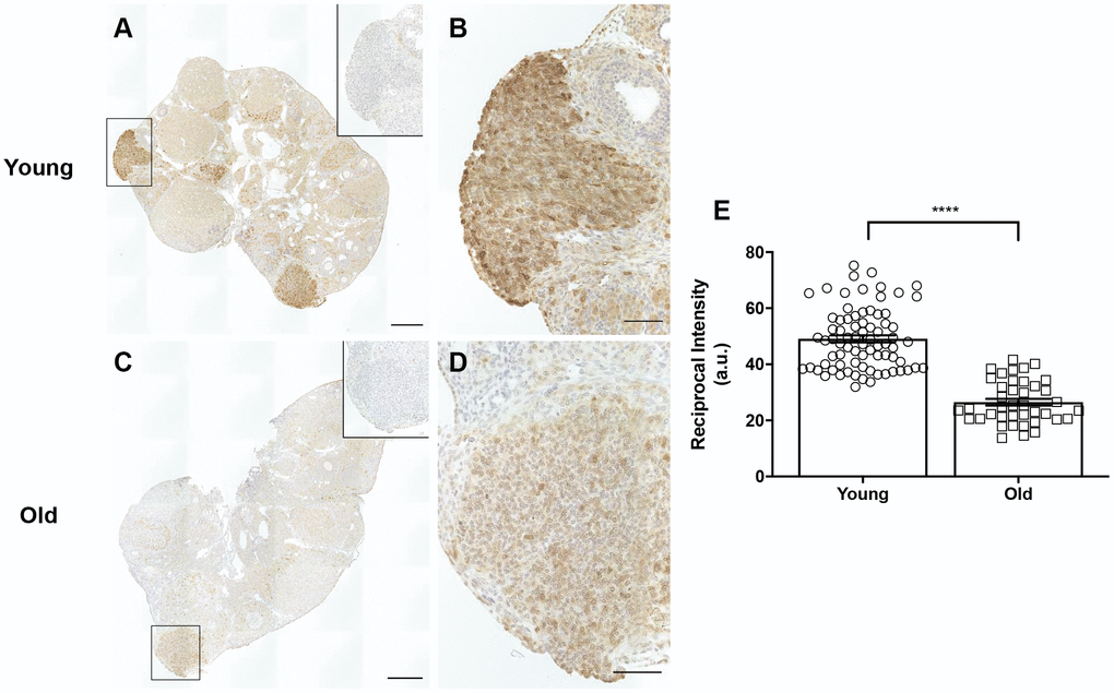 COX2 expression is decreased in reproductively old ovaries. (A) Representative image of a reproductively young ovary stained for COX2 expression. (B) Magnified image of boxed region in (A), a site of recent follicle rupture. (C) Representative image of a reproductively old ovary stained for COX2 expression. (D) Magnified image of boxed region in (C). The insets are IgG controls of the boxed regions. Scale bars are (A, C) 100 μm and (B, D) 25 μm. (E) Graph showing the reciprocal intensity values of recently ruptured follicles and formed CLs in tissue from reproductively young and old mice. A.u. stands for arbitrary units. A t-test was performed; asterisks indicate P ± SEM.