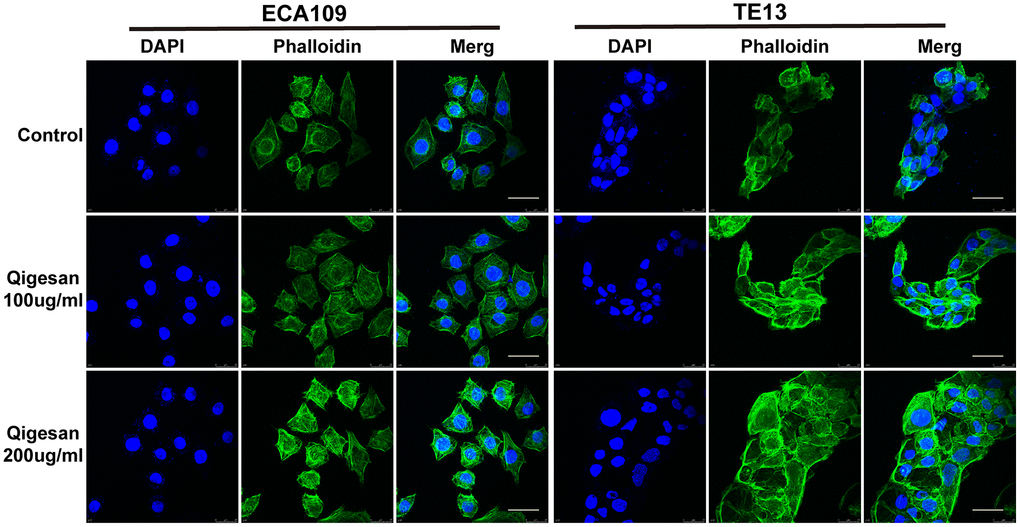 ECA109 and TE13 cytoskeleton and microfilament structures. After QGS stimulation, isotropic arrangement of microfilaments was enhanced in ECA109 and TE13 cells; microfilament arrangement was disordered in the control group. In addition, microfilament arrangements were more regular and numbers of pseudopods were reduced after 200 μg/mL of QGS. Scale bars indicate 10 μm.