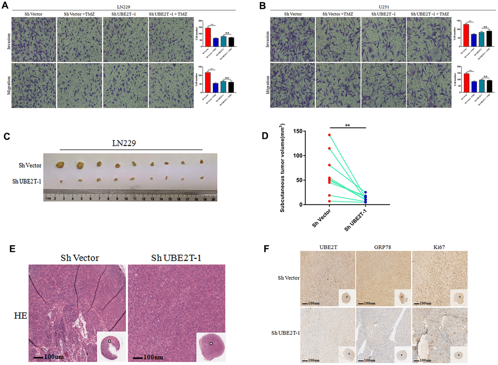 The function of Ubiquitin-conjugating enzyme E2T (UBE2T) was uncovered in vivo. (A, B) The effects of transfection with short hairpin RNA (shRNA) targeting UBE2T-1, treatment with temozolomide (TMZ, 200 μM) or both on the invasion and migration of LN229 (A) and U251 (B) cells. (C, D) LN229 cells transfected with ShUBE2T-1 or the control vector (Sh Vector) were subcutaneously injected (5 × 106 cells per mouse) into 6-week-old nude mice (n = 9). Representative images (left) (C) and quantitative analysis (right) (D) of subcutaneous tumour volumes. (E) Haematoxylin and eosin (HE) staining was performed to illustrate the tumour cytostructure. (F) Immunohistochemical staining of UBE2T, GRP78 and Ki-67 in ShUBE2T-1 and ShVector subcutaneous tumour samples (×100). Scale bar, 100 μm. (Error bars indicate the SEM of three independent experiments. Two-tailed Student’s t-test. *, P 