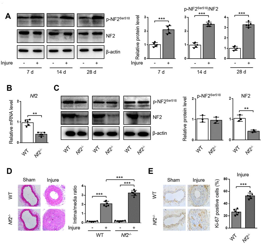 NF2 knockdown enhances neointima hyperplasia after vascular injury. WT or Nf2-/- mice received sham operation or wire injury in common carotid artery. (A) The relative protein levels of p-NF2Ser518 and NF2 in common carotid arteries from C57BL/6J mice at day 7, 14 and 28 after injury were analyzed by immunoblotting (n=5). (B) The relative mRNA (n=5) level of Nf2 in common carotid arteries from WT or Nf2-/- mice. (C) The relative protein (n=3) levels of p-NF2Ser518 and NF2 in common carotid arteries from WT or Nf2-/- mice. (D) Representative H&E staining of carotid arteries from WT or Nf2-/- mice at day 28 after sham operation or wire injury (left) and corresponding quantification for ratio of intima/media (right) were shown (n=6). Magnification 200×. (E) Immunohistochemistry staining of Ki-67 (brown) in sections of carotid arteries from WT or Nf2-/- mice at day 28 after sham operation or wire injury (left) and corresponding quantification for Ki-67 positive cells within neointima (right) were shown (n=6). Magnification 200×. Data are shown as mean ± S.D. *PPP