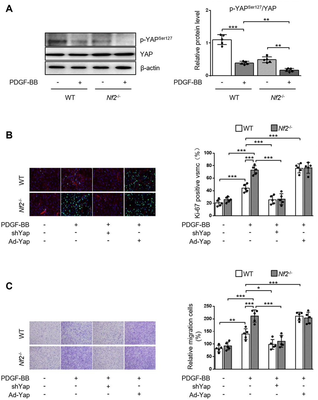 NF2 knockdown accelerates PDGF-BB-induced VSMC proliferation and migration in a YAP-dependent manner. VSMC isolated from WT or Nf2-/- mice was transfected by shCon, shYap, Ad-Con and Ad-Yap. Then the VSMC received 48 h of physiological saline or PDGF-BB (30 ng/mL) treatment. (A) The relative protein expression levels of p-YAPSer127 and YAP were determined by immunoblotting in VSMC treated as above mentioned (n=5). (B) VSMC treated as above mentioned was stained with SM α-actin (red), Ki-67 (green) and DAPI (blue). Representative images (left) and corresponding quantification of Ki-67-positive VSMC (right) were shown (n=5). Magnification 400×. (C) VSMC treated as above mentioned was assessed by transwell assay. Representative images (left) and corresponding quantification of migration cells (right) were shown (n=5). Magnification 100×. Data are shown as mean ± S.D. *PPP