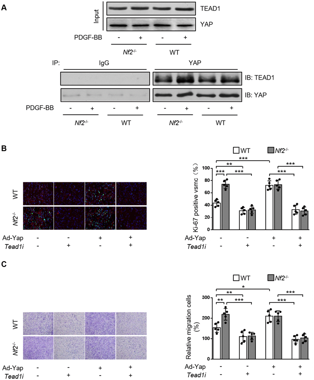 NF2 knockdown causes increased VSMC proliferation and migration induced by PDGF-BB via inducing YAP-TEAD1 interaction. (A) VSMC isolated from WT or Nf2-/- mice after 48 h of physiological saline or PDGF-BB (30 ng/mL) treatment was subjected to immunoprecipitation using anti-YAP antibody or control IgG. Inputs and immunocomplexes were analyzed by immunoblotting. VSMC isolated from WT and Nf2-/- mice was transfected with control siRNA, Teadi or Ad-Con, Ad-Yap and then treated by physiological saline or PDGF-BB (30 ng/mL) for 48 h. (B) VSMC treated as above mentioned was stained with SM α-actin (red), Ki-67 (green) and DAPI (blue). Representative images (left) and corresponding quantification of Ki-67-positive VSMC (right) were shown (n=5). Magnification 400×. (C) VSMC treated as above mentioned was assessed by transwell assay. Representative images (left) and corresponding quantification of migration cells (right) were shown (n=5). Magnification 100×. Data are shown as mean ± S.D. *PPP