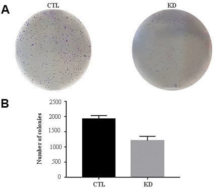 Colony formation capacity of UM 92.1 cells KD for macroH2A1. UM 92.1 cells were silenced for macroH2A1 expression as in Figure 1. (A) Images are representative of three separate experiments. (B) The number of colonies was manually counted and presented as the mean ± SEM of three independent experiments. (*p 