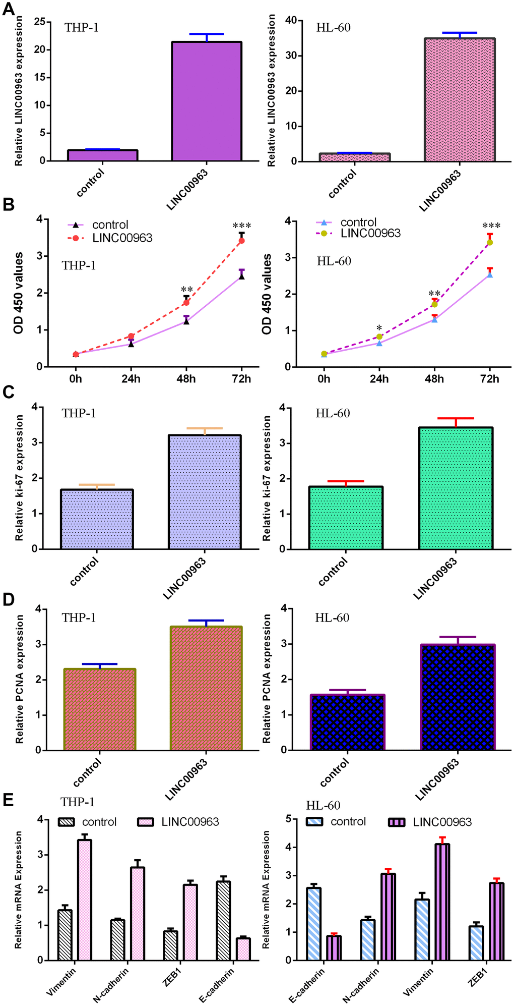 Overexpression of LINC00963 promoted AML cell growth and EMT progression. (A) The expression of LINC00963 was measured by RT-qPCR in both THP-1 and HL-60 AML cells. (B) CCK-8 assay showed that overexpression of LINC00963 accelerated cell growth in both THP-1 and HL-60 cells. (C) Elevated expression of LINC00963 facilitated ki-67 expression in both THP-1 and HL-60 cells. (D) RT-qPCR assay indicated that elevated expression of LINC00963 accelerated PCNA levels in both THP-1 and HL-60 cells. (E) Ectopic expression of LINC00963 enhanced Vimentin, N-cadherin and ZEB1 expression and decreased E-cadherin expression in both THP-1 and HL-60 cells. *p