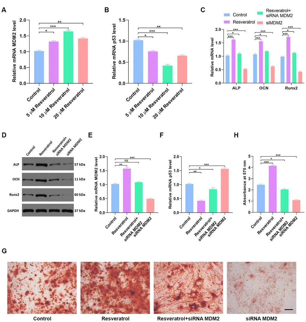 Resveratrol partially reverses p53-induced inhibition of osteogenic differentiation. (A) Effects of different concentrations of resveratrol on MDM2 expression were measured by qRT-PCR. (B) p53 expression in different groups was assessed by qRT-PCR. (C, D) Osteogenic genes expression in different groups was measured by qRT-PCR and western blot. (E) MDM2 expression in hMSCs after different treatments was assessed by qRT-PCR. (F) p53 expression in different groups was assessed by qRT-PCR. (G–H) Alizarin red-mediated calcium staining in hMSCs 21 days after transfection with different constructs. Scale bar = 10mm. Data are means ± SD. *p 