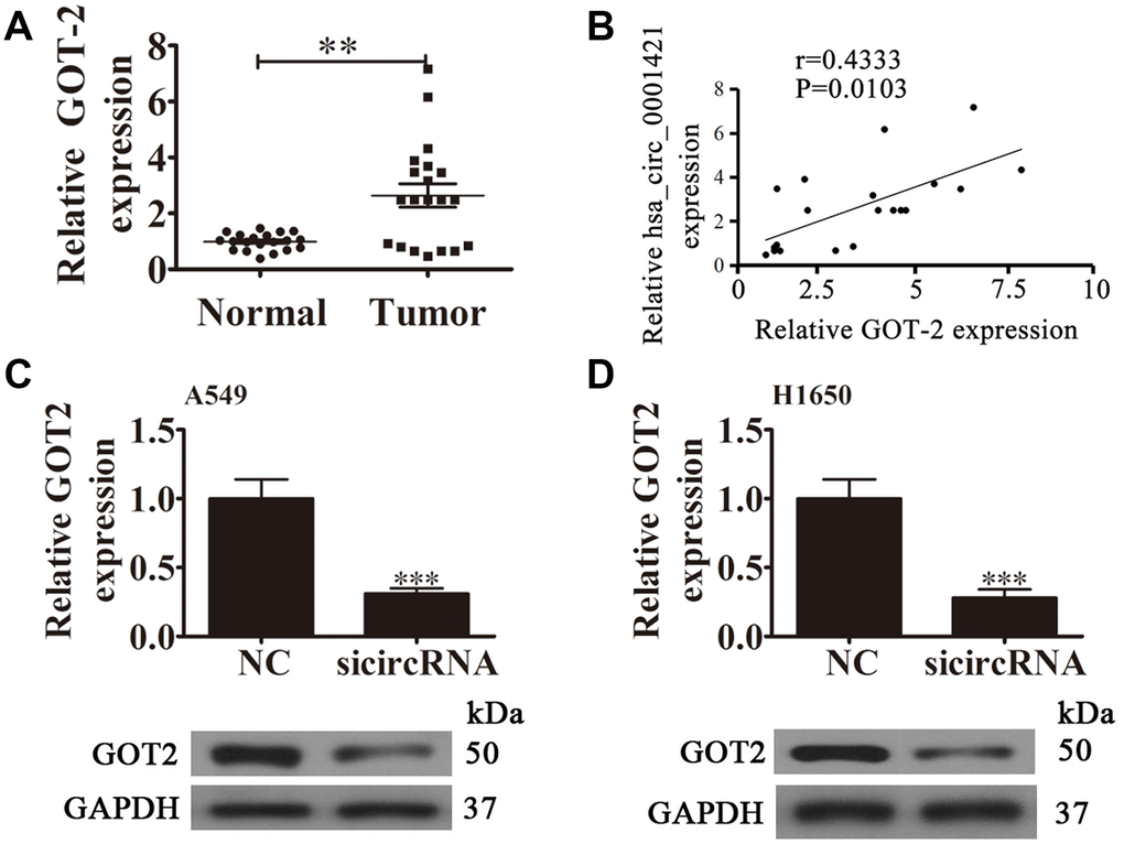 The relationship between circ-SEC31A and GOT2. (A) RT-qPCR showing the relative GOT2 expression from 20 NSCLC tumor tissues and adjacent non-tumor tissues. Data are presented as mean ± SD; **pB) A significant positive correlation between circ-SEC31A and GOT2 was detected in NSCLCs tissues; n=20, P=0.0103. (C and D) RT-qPCR and western blot detection showing the expression of GOT2 in both A549 (C) and H1650 (D) cells. Data are presented as mean ± SD; ***P