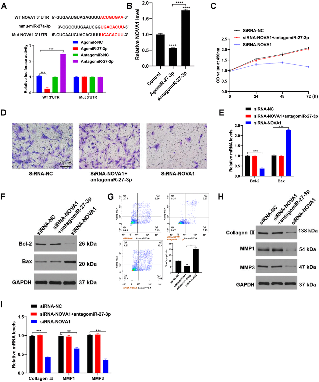 NOVA1 is a novel target of miR-27-3p. (A) The predicted miR-27-3p binding site within the NOVA1 3’-UTR was determined by Targetscan (Upper). miR-27-3p suppresses NOVA1 3’-UTR reporter activity (Lower). (B) qRT-PCR analysis showing that NOVA1 expression is suppressed in fibroblasts transfected with agomiR-27-3p. (C) CCK8 assays used to assess fibroblast proliferation. (D) Transwell assays were used to assess fibroblast migration capacity. (E, F) Expression of pro-apoptotic and anti-apoptotic proteins was detected with qRT-PCR and Western blotting. (G) Flow cytometry evaluating the cell cycle in fibroblasts. (H, I) The ECM-related proteins collagen III, MMP1 and MMP3 were evaluated with Western blotting and qRT-PCR.