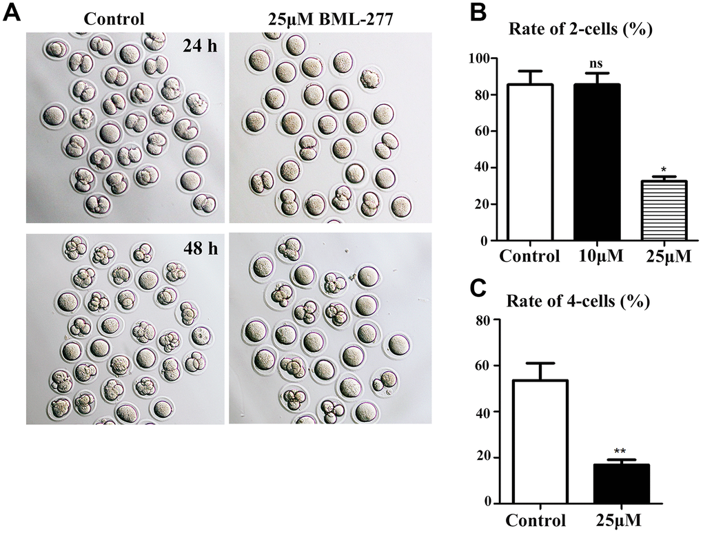 Disruption of CHK2 activity inhibited cleavage during early embryonic development in mice. (A) Representative image showing the development of early embryos in the 25 μM treatment group and the control group at 24 h and 48 h. (B) The rate of 2-cell embryo formation in the 25 μM treatment group was significantly lower than that in the control group (32.5 ± 2.63%, n = 137, 25 μM vs. 85.5 ± 7.42%, n = 158, control, p C) The rate of 4-cell embryo formation in the 25 μM treatment group was significantly lower than that in the control group (16.8 ± 2.22%, n = 236, 25 μM vs. 53.6 ± 7.44%, n = 260, control, p 