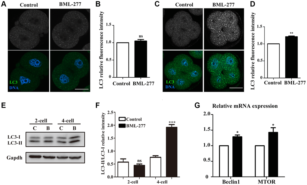 Inhibition of CHK2 induced autophagy during early embryonic development in mice. (A) Embryos at the 2-cell stage were immunolabeled with anti-LC3 antibody (green), and Hoechst 33342 was used to label DNA (blue). Bar = 30 μm. (B) The fluorescence intensity of LC3 in embryos in the 25 μM treatment group and control group. (C) Embryos at the 4-cell stage in the control and CHK2 inhibition groups were immunolabeled with anti-LC3 antibody (green), and Hoechst 33342 was used to label DNA (blue). Bar = 30 μm. (D) The fluorescence intensity of LC3 in embryos in the 25 μM treatment group and control group. (E) The protein expression of LC3-I/II in embryos at the 2-cell and 4-cell stages in the control and CHK2 inhibition groups. (F) Band intensity analysis of LC3-I/II in embryos in the control and CHK2 inhibition groups. (G) The expression of autophagy-related genes in the 25 μM and control groups. ***significant difference (p 