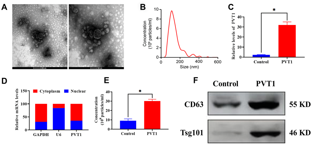 PVT1 stimulates exosome secretion in HS766T cells. (A) Representative images of exosomes derived from HS766T cells, as detected by TEM. Scale bar: 200 nm (left) and 100 nm (right). (B) The size distribution of exosomes, as determined by NTA. (C) The transfection efficiency of PVT1 overexpression in HS766T cells. (D) The expression of PVT1 in the nucleus and cytoplasm of HS766T cells. (E) The concentration of exosome derived from PVT1-overexpressing HS766T cells. (F) The protein expression of exosome markers in PVT1-overexpressing HS766T cells. *P 