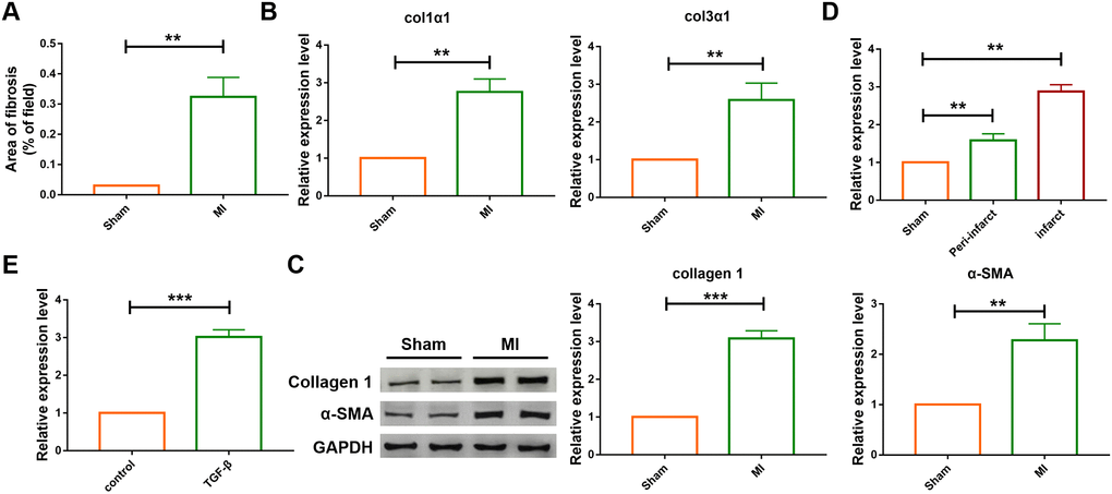 The differential expression of SNHG7 in cardiac tissues and cardiac fibroblast. (A) Quantification of the total fibrotic area using Image-J. Fibrosis areas of sham-operated group and MI group were detected by Masson staining. Data was presented as mean ± SEM; two-tailed t test was used for the statistical analysis. n=7 mice per group. (B) mRNA expression of collagen 1α1 and collagen 3α1 were measured by qRT-PCR; GAPDH mRNA served as an internal control. Data was presented as mean ± SEM; two-tailed t test was used for the statistical analysis. n=6 mice per group. (C) Protein levels of collagen 1 and α-SMA were measured by western blotting analysis; GAPDH served as an internal control. Data was presented as mean ± SEM; two-tailed t test was used for the statistical analysis. n=6 mice per group. (D) qRT-PCR analysis showing upregulation of lncRNA SNHG7 in the peri-infarcted and infarcted areas of left ventricle of mice after MI. Data was presented mean ± SEM; two-tailed t test was used for the statistical analysis. n=5 mice per group. (E) qRT-PCR analysis showing elevation of lncRNA SNHG7 in cardiac fibroblasts after treatment with TGF-β1 (10 ng/mL) for 24h. Data was presented as mean ± SEM; two-tailed t test was used for the statistical analysis. n=5 independent cell cultures. **PP