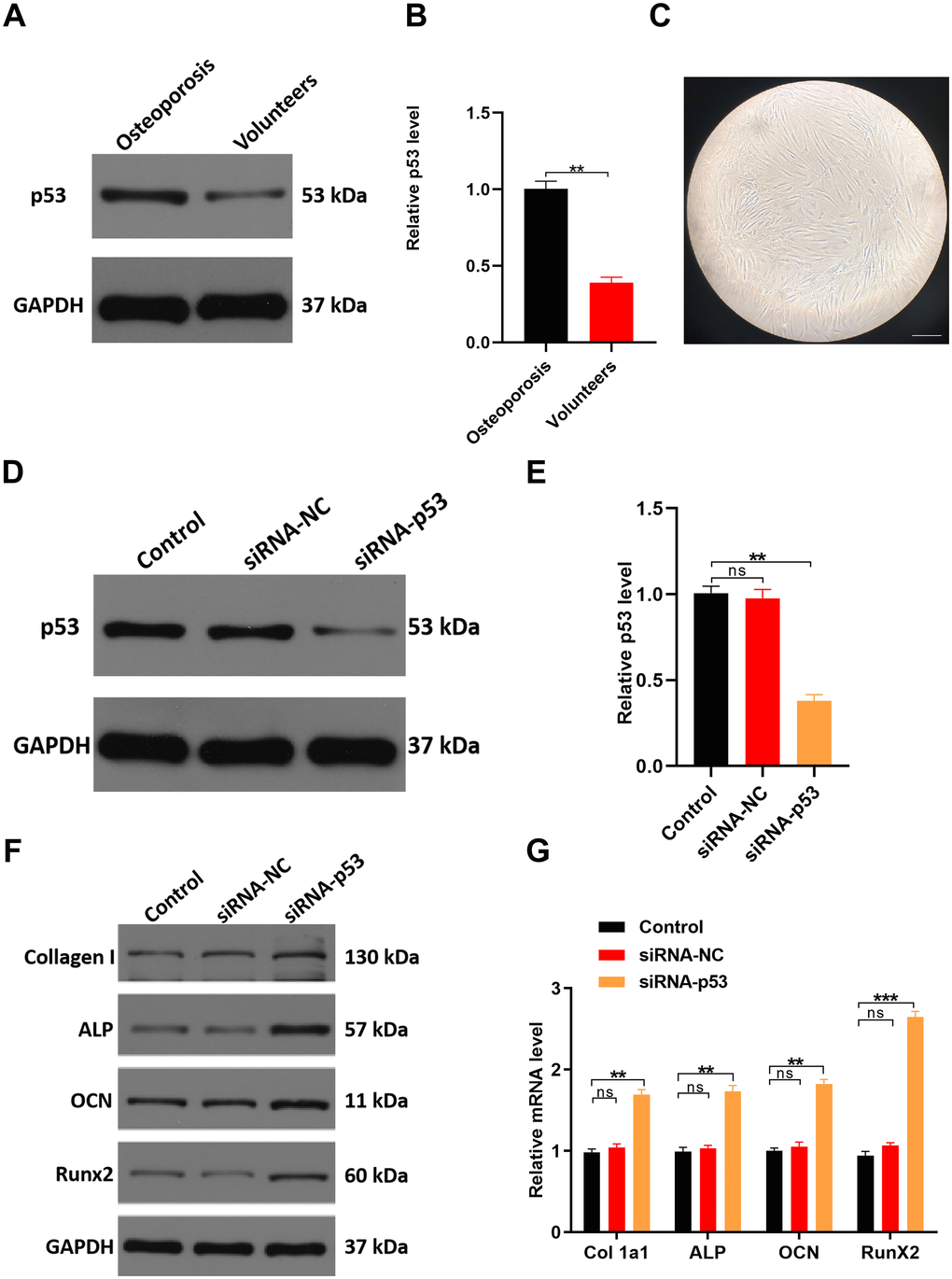 Downregulating p53 expression may protect against osteoporosis in vitro. (A, B) qRT-PCR and western blot analyses comparing p53 expression between healthy volunteers and osteoporosis patients. (C) Cellular morphology of hMSCs, scale bar, 50 μm. (D, E) hMSCs were treated with PBS, siRNA-NC, or siRNA-p53, after which p53 expression was assessed with qRT-PCR and western blotting. (F, G) qRT-PCR and western blot analysis of osteogenesis-related mRNAs in the three groups. Data are means±SD of triplicate experiments. *p 