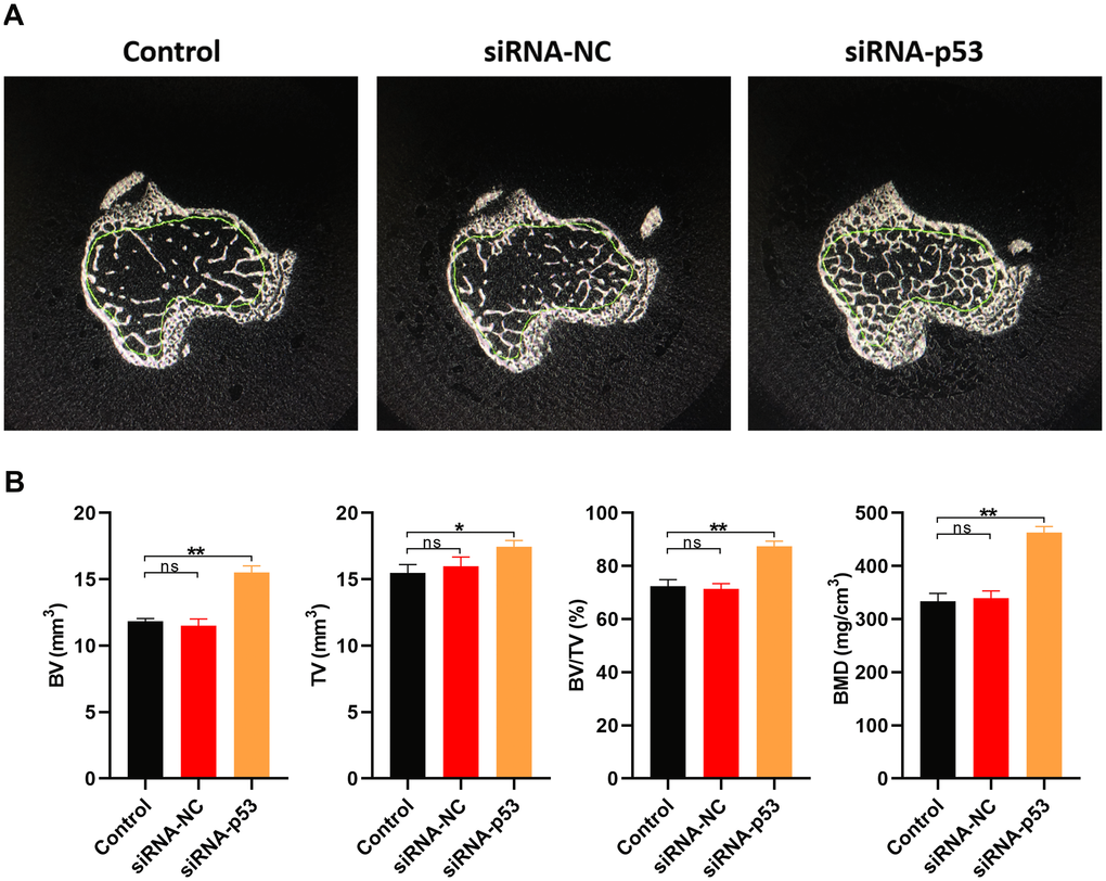 Downregulating p53 expression may protect against osteoporosis in vivo. (A) Cross sections of bone samples from osteoporosis model mice treated for 10 weeks with PBS, siRNA-NC, or siRNA-p53 (n=10 in each group). (B) BV, TV, BV/TV, and BMD values measured in osteoporosis model mice in each treatment group. Data are means±SD of triplicate experiments. *p 