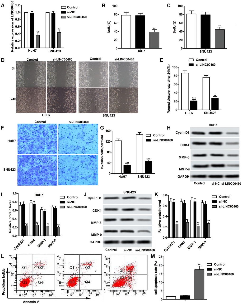 Knockdown of LINC00460 suppresses HCC cell proliferation, migration and invasion. Specific si-LINC00460 was transfected into HuH7 and SNU423 cells, respectively. si-NC was used as a blank. (A) Relative expression of LINC00460 in HuH7 and SNU423 cells was detected through qRT-PCR. (B, C) Bromodeoxyuridine assay was used to value cell proliferation in HuH7 and SNU423 cells, respectively. (D, E) Wound healing assay was conducted to value cell migration ability. Data statistics was also shown. (F, G) Transwell invasion assay showed the invasive cells in each group. Data statistics was also shown. (H, I) Western blot showed the expression of cell proliferation related proteins CyclinD1 and CDK4 and cell migration related proteins MMP-3 and MMP-9 in HuH7 cells. Data statistics was also shown. (J, K) Western blot showed the expression of CyclinD1, CDK4, MMP-3 and MMP-9 in SNU423 cells. Data statistics was also shown. (L) Flow cytometry was conducted to value cell apoptosis. (M) Cell apoptosis rate was calculated and presented. **P ***P 