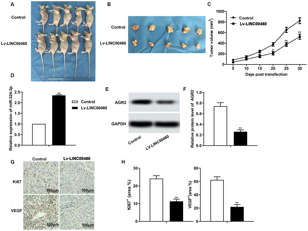 Knockdown of LINC00460 suppresses HCC progression in vivo. (A, B) Pictures about tumor growth in the Lv-LINC00460 group and the control group was shown (C). Corresponding tumor growth curve. (D) The level of miR-342-3p was detected through qRT-PCR. (E, F) The expression of AGR2 was detected through western blot and data statistics was also shown. (G–H) Immunohistochemical (IHC) was conducted to examine the expression of Ki67 and VEGF in tissues. *P **P 