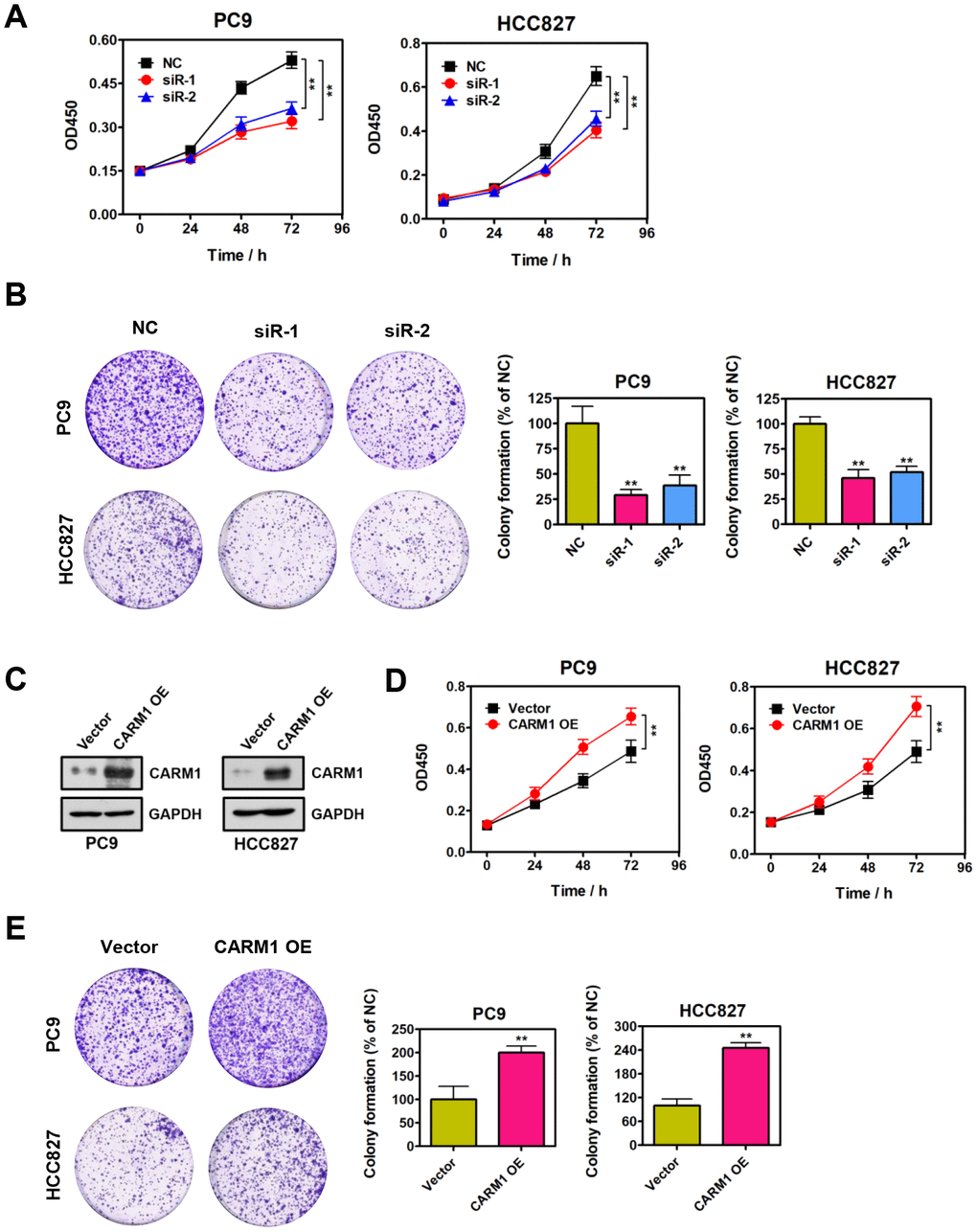 CARM1 promotes NSCLC cell proliferation in vitro. (A) Cell proliferation abilities of CARM1-depleted PC9 and HCC827 cells were assessed by CCK-8 assays. The data were presented as means ± SDs of three independent experiments; **P B) Colony-formative abilities of CARM1-depleted PC9 and HCC827 cells were determined by colony-formation assays. Right panel, the relative colony-formative abilities (% of NC) were quantified. The data were shown as means ± SDs of three independent experiments; **P C) Overexpression of CARM1 in PC9 and HCC827 cells was examined by Western blot. GAPDH was used as loading control. (D) Cell proliferative abilities of CARM1-overexpressed PC9 and HCC827 cells were assessed by CCK-8 assays. The data were presented as means ± SDs of three independent experiments; **P E) Colony-formative abilities of CARM1-overexpressed PC9 and HCC827 cells were determined by colony-formation assays. Right panel, the relative colony-formative abilities (% of NC) were quantified. The data were shown as means ± SDs of three independent experiments; **P 