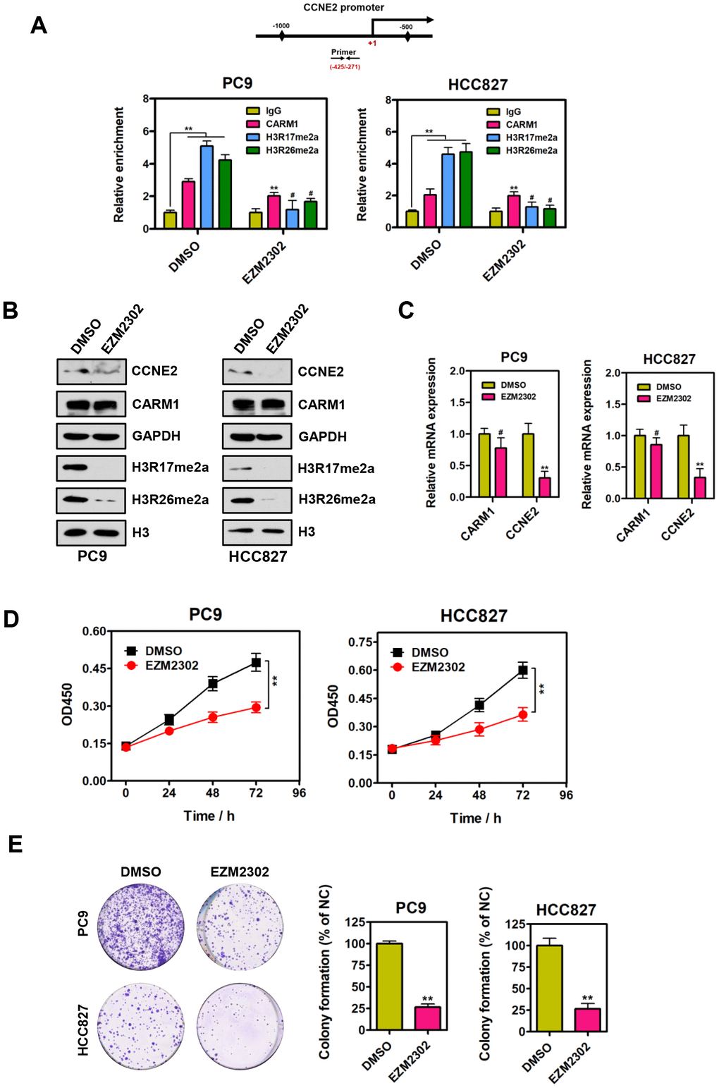 Inhibition of CARM1 enzymatic activity represses CCNE2 expression in NSCLC cells. (A) ChIP analysis of human CCNE2 promoter by antibodies against CARM1, H3R17me2a, H3R26me2a or IgG in DMSO or EZM2302-treated (10 nM) PC9 and HCC827 cells. Relative enrichment of CARM1, H3R17me2a and H3R26me2a marks on the promoter regions was analyzed by real-time PCR assays. The data were presented as means ± SDs of three independent experiments; **P #P > 0.05. (B) The protein levels of CCNE2, H3R17me2a and H3R26me2a were downregulated in EZM2302-treated (10 nM) PC9 and HCC827 cells by Western blot. GAPDH or histone H3 were used as loading controls. (C) The mRNA levels of CCNE2 was downregulated in EZM2302-treated (10 nM) PC9 and HCC827 cells by Real-time PCR assays. β-actin was used as an internal control. The data were shown as means ± SDs of three independent experiments; **P D) Cell proliferation abilities of DMSO or EZM2302-treated (10 nM) PC9 and HCC827 cells were assessed by CCK-8 assays. The data were presented as means ± SDs of three independent experiments; **P E) Colony-formative abilities of DMSO or EZM2302-treated (10 nM) PC9 and HCC827 cells were determined by colony-formation assays. Right panel, the relative colony-formative abilities (% of NC) were quantified. The data were shown as means ± SDs of three independent experiments; **P 