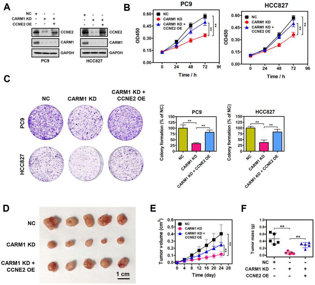 Restoration of CCNE2 expression abrogates the proliferation inhibition caused by CARM1 knockdown. (A) The restoration of CCNE2 in CARM1-depleted PC9 and HCC827 cells was verified by Western blot. GAPDH was used as loading control. (B) Cell proliferation capacities of NC, CARM1 KD (CARM1 shRNA) and CARM1 KD + CCNE2 OE (CCNE2 overexpression)-treated PC9 and HCC827 cells were determined by CCK-8 assays. The data were presented as means ± SDs of three independent experiments; **P C) Colony-formative abilities of NC, CARM1 KD and CARM1 KD + CCNE2 OE-treated PC9 and HCC827 cells were determined by colony-formation assays. Right panel, the relative colony-formative abilities (% of NC) were quantified. The data were shown as means ± SDs of three independent experiments; **P D) NC, CARM1 KD and CARM1 KD + CCNE2 OE-treated PC9 cells were subcutaneously injected into the flank of nude mice. Representative images of xenograft tumors excised from mice. (E) Tumor growth curves of NC, CARM1 KD and CARM1 KD + CCNE2 OE-treated PC9 cells in nude mice; n =5, **P F) Tumor weights of NC, CARM1 KD and CARM1 KD + CCNE2 OE-treated PC9 xenograft tumors excised from mice; n =5, **P 