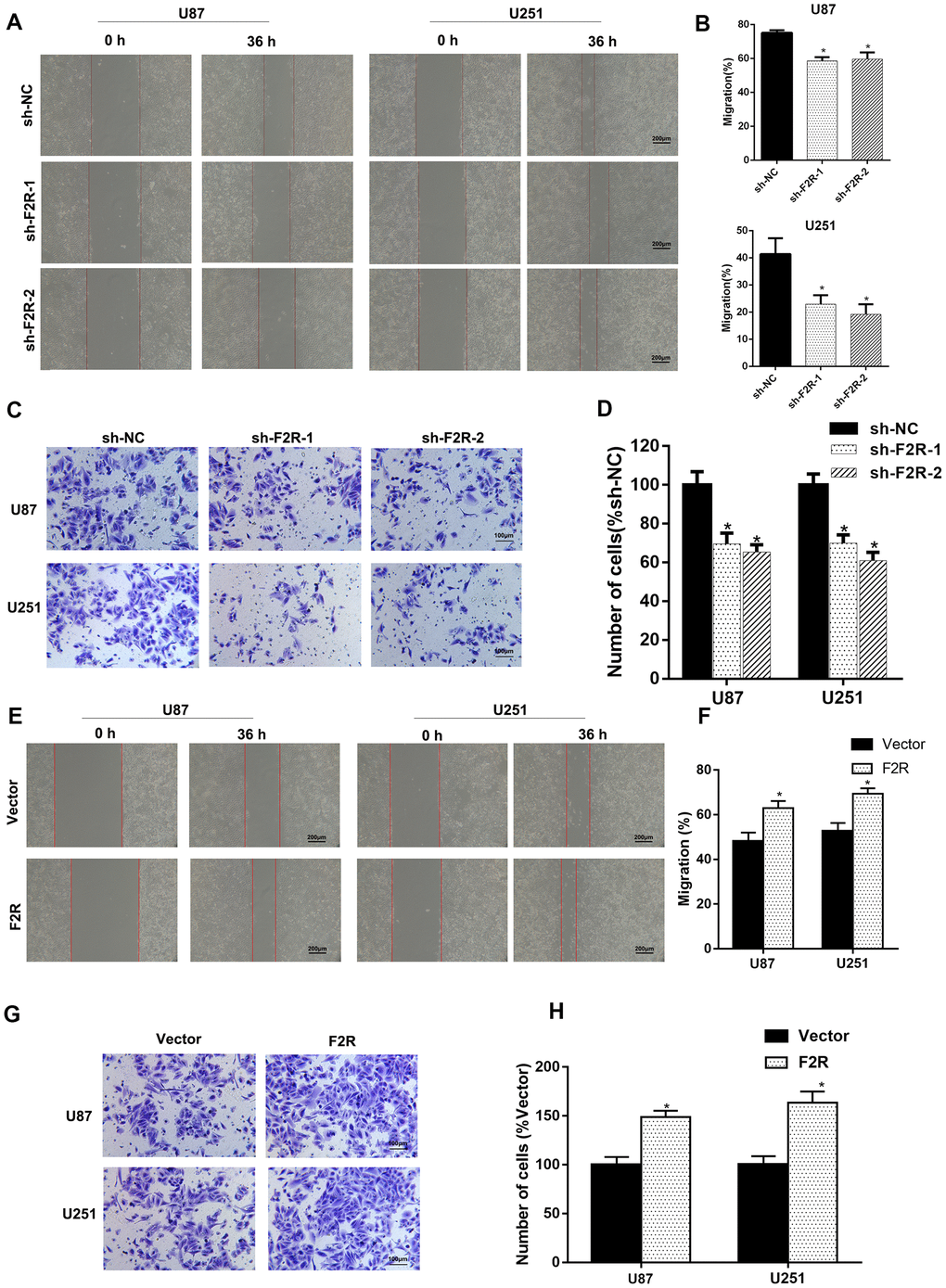 F2R plays an important role in the metastasis and invasion of glioma cells. (A, B). Wound-healing assay showed that F2R knockdown suppressed U87 and U251 cells migration. Representative images (A) and average migration rate (B) are shown. (C, D). Transwell assay showed that F2R knockdown suppressed glioma cell invasion. Representative images (C) and average number of cells (D) are shown. (E, F) Wound-healing assay showed that F2R overexpression promoted U87 and U251 cells migration. Representative images (E) and average migration rate (F) are shown. (G, H). Transwell assays showed that F2R overexpression promoted glioma cell invasion. Representative images (G) and average number of cells (H) are shown. All experiments were repeated at least three times. Data are presented as the mean ± SEM. *P