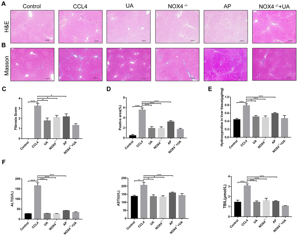 The effect of UA on CCl4-induced liver injury and fibrosis is related to NOX4. (A) HE staining (100× magnification). (B) Masson’s trichrome staining (100× magnification). (C–D) Morphometrical analysis of the fibrotic score and fibrotic area. (E) Detection of the hydroxyproline content in the liver tissue by colorimetry. (F) Liver function indices in mouse sera. Data represent the mean ± SD for each group. *P 