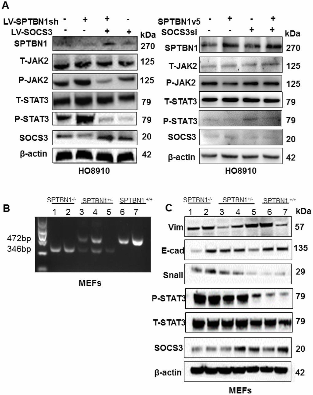 Loss of SPTBN1 activates the JAK/STAT3 signaling pathway through downregulation of SOCS3. (A) Assessments of JAK/STAT signaling pathway-associated proteins by western blot after SPTBN1 knockdown cooperated with SOCS3 overexpression in HO8910 cells (left), and SPTBN1 overexpression cooperated with SOCS3 knockdown (right). (B) DNA gel electrophoresis after PCR. Mouse embryonic fibroblasts (MEFs) were cultured from SPTBN1-/- embryos (n=2), SPTBN1+/- embryos (n=3) and wild-type embryos (n=2). The genotypes of MEFs were identified by PCR and DNA gel electrophoresis. Lanes 1 and 2: SPTBN1-/- MEFs; lanes 3, 4, and 5: SPTBN1+/- MEFs; lanes 6 and 7: SPTBN1-/- MEFs. (C) Assessments of EMT and JAK/STAT3 signaling pathway-associated proteins by western blot in SPTBN1-/-, SPTBN1+/-, and SPTBN1+/+ MEFs. Lanes 1 and 2: SPTBN1-/- MEFs; lanes 3, 4, and 5: SPTBN1+/- MEFs; lanes 6 and 7: SPTBN1-/- MEFs. Loss of SPTBN1 can promote EMT, inhibit SOCS3 and activate the JAK/STAT signaling pathway.