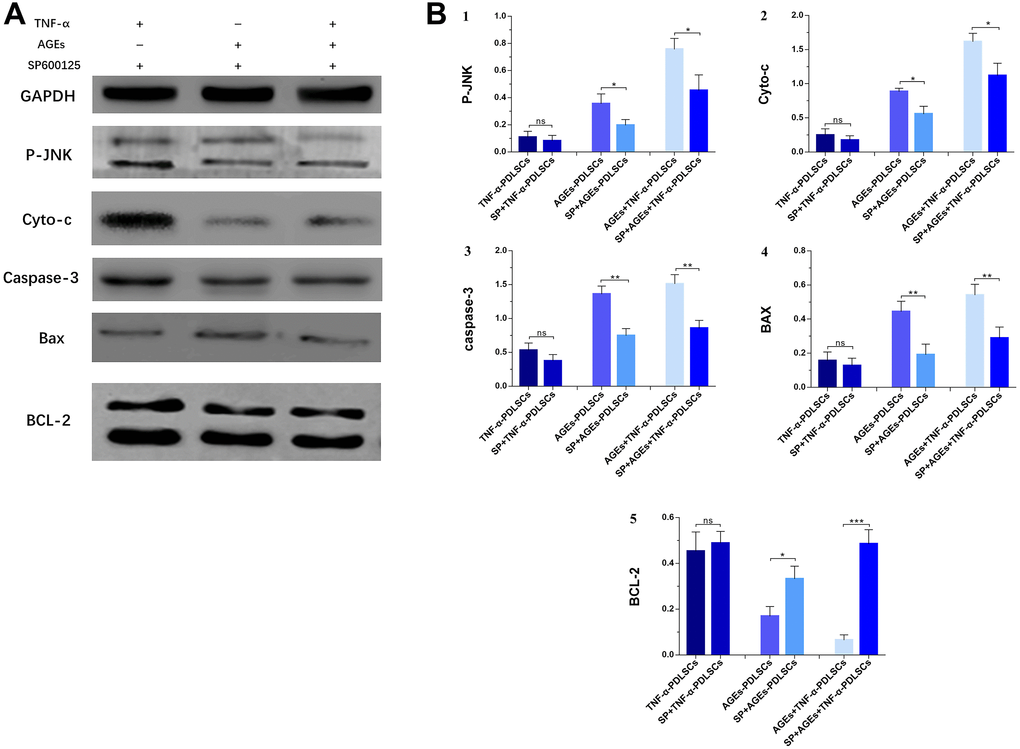 Each group of cells was pretreated with SP600125 for 30 minutes and then loaded with corresponding stimuli, protein expression levels and its quantification of P-JNK, Cyto-c, caspase-3, Bax and BCL-2 in various experimental groups (A). The gray value was detected for bar graph (B). Data are presented as the mean±standard deviation (SD) (n=3). (ns P>0.05, * P