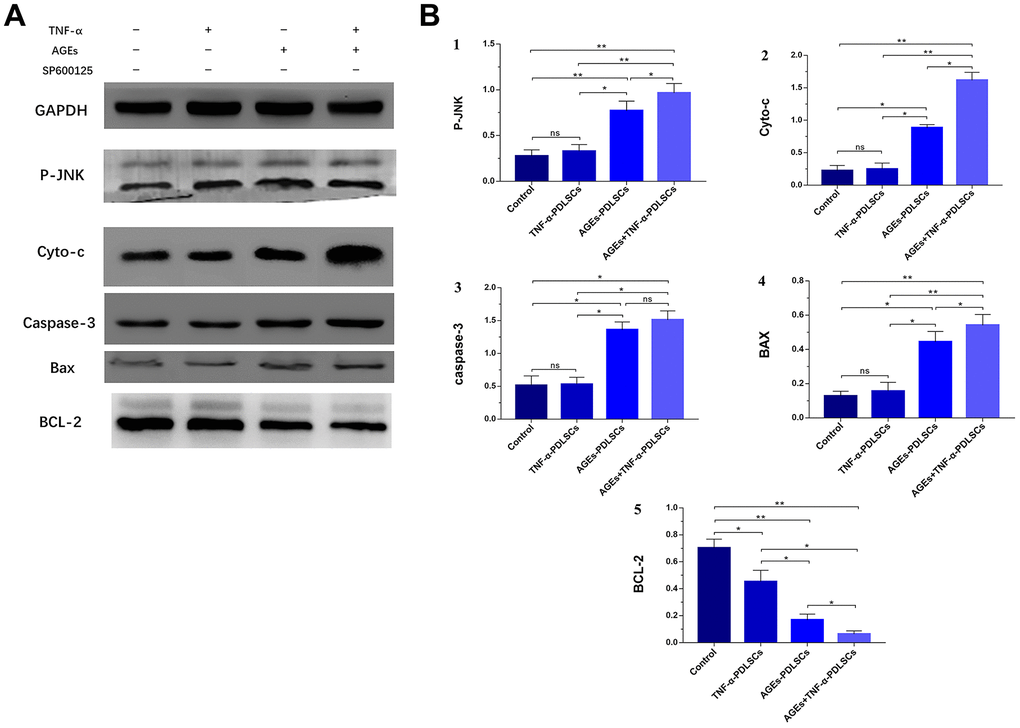 After culturing PDLSCs in AGEs and/or TNF-α medium for 72 hours, protein expression levels and its quantification of P-JNK, Cyto-c, caspase-3, Bax and BCL-2 in various experimental groups (A). The gray value was detected for bar graph (B). Data are presented as the mean±standard deviation (SD) (n=3). (ns P>0.05, * P