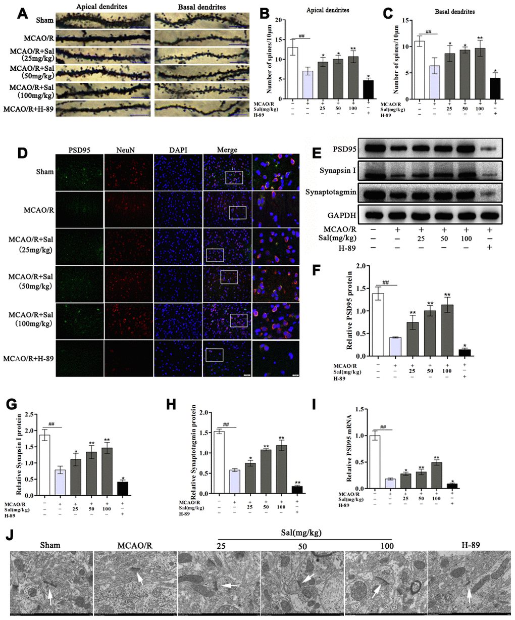 Sal promotes increases in dendritic spine density and synaptic-associated protein expression via upregulating the FGF2-mediated cAMP/PKA/CREB signaling pathway. (A) Examples of dendritic spines (the scale bar is 10 μm). (B, C) Density of dendritic spines. (D) Double immunofluorescence staining of PSD95-positive (green) and NeuN-positive (red) neurons from sections in each group on day 7 after MCAO/R (the scale bars are 20 and 10 μm). (E–H) Representative western blot bands of PSD95, synapsin I and synaptotagmin in each group. (I) QPCR data for PSD95. (J) Transmission electron microscopy showed the synaptic structures (the scale bar is 1 μm). Values are expressed as the mean ± SD. #p ##p *p **p 