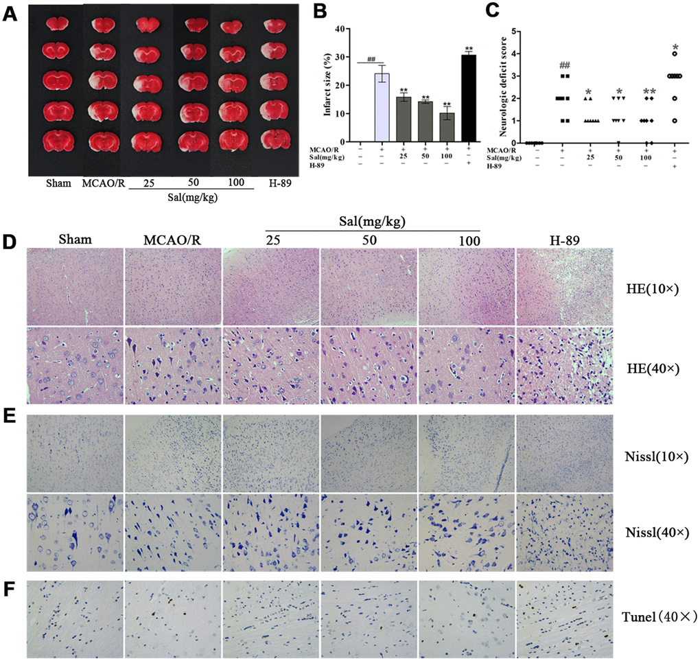 Sal ameliorates tissue structure damage in the ischemic penumbra after MCAO/R. (A, B) Representative images of ischemic lesions and statistical analysis of infarct volume at 7 days postinjury. (C) Neurological deficits. (D) HE staining at 7 days after MCAO/R (the scale bars are 100 μm and 20 μm). (E) Nissl staining images (the scale bars are 100 μm and 20 μm). (F) TUNEL staining in the ischemic penumbra (the scale bar is 20 μm). Values are expressed as the mean ± SD. #p ##p *p **p 