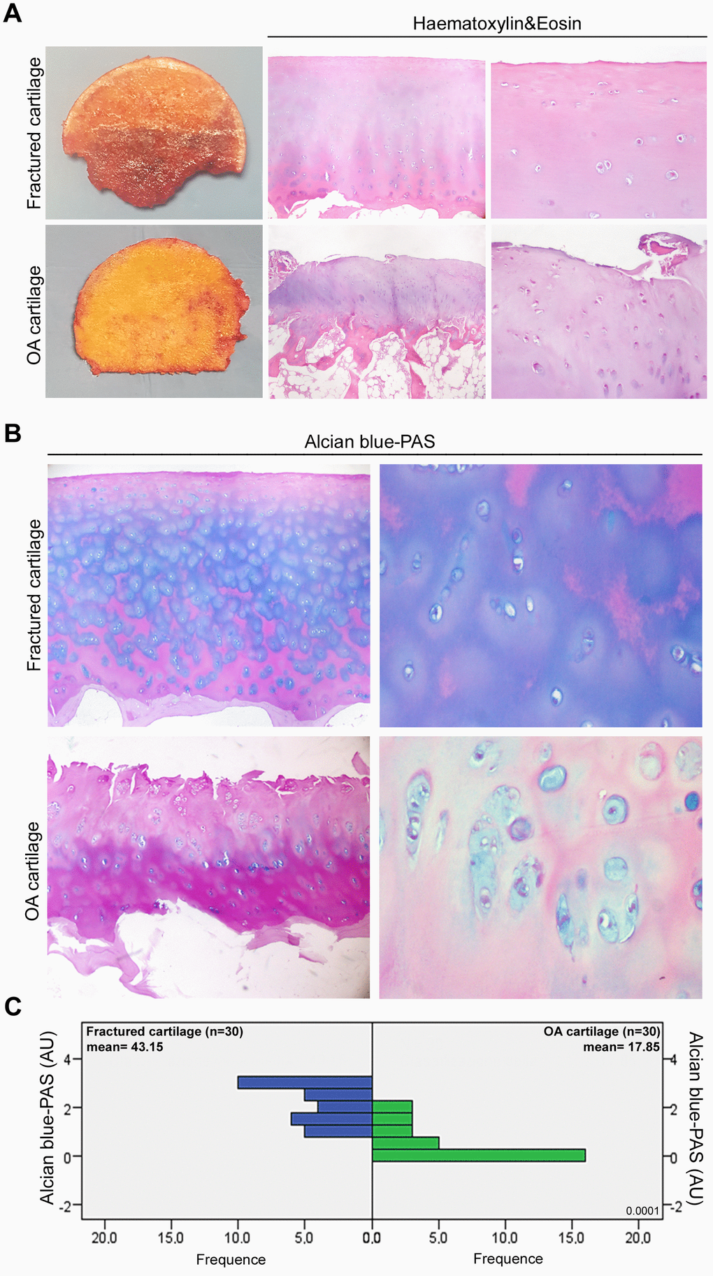 Histopathological features of OA articular cartilage. (A) Representative macroscopic images of fractured and OA femoral head samples (left panel) and Haematoxylin&Eosin-stained sections of articular cartilage at low and high magnification (center and right panel). (B) Representative images at different magnification of Alcian blue-PAS staining and (C) alcianophilia in the extracellular matrix of articular cartilage of fractured (n=30 donors; blue bars) and OA patients (n=30 donors; green bars). Abbreviations: A.U., arbitrary units. Mann-Whitney’s U-test: P 