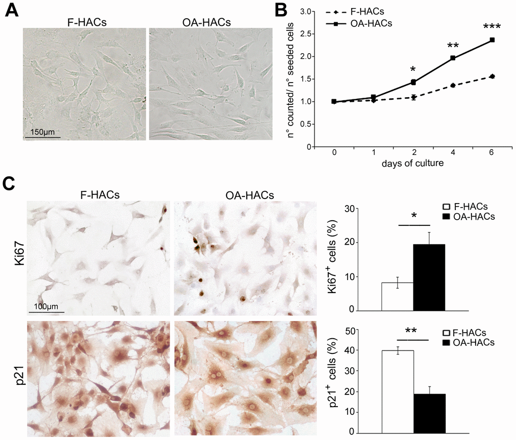 Morphology and proliferation rate of chondrocytes from OA and fractured patients in vitro. (A) Phase contrast micrographs of human chondrocytes in culture from articular cartilage of fractured and OA patients (F-HACs and OA-HACs). (B) Growth curve of F-HACs and OA-HACs in culture. (C) Representative images of Ki67 and p21 immunocytochemistry on F-HACs and OA-HACs. Bar graphs show the percentage of Ki67+ and p21+ cells. Data are expressed as mean values ± SEM of three independent experiments. Abbreviation: F-HACs, fractured patient human articular chondrocytes; OA-HACs, OA-Human articular chondrocytes. Student’s t-test: *P P P 