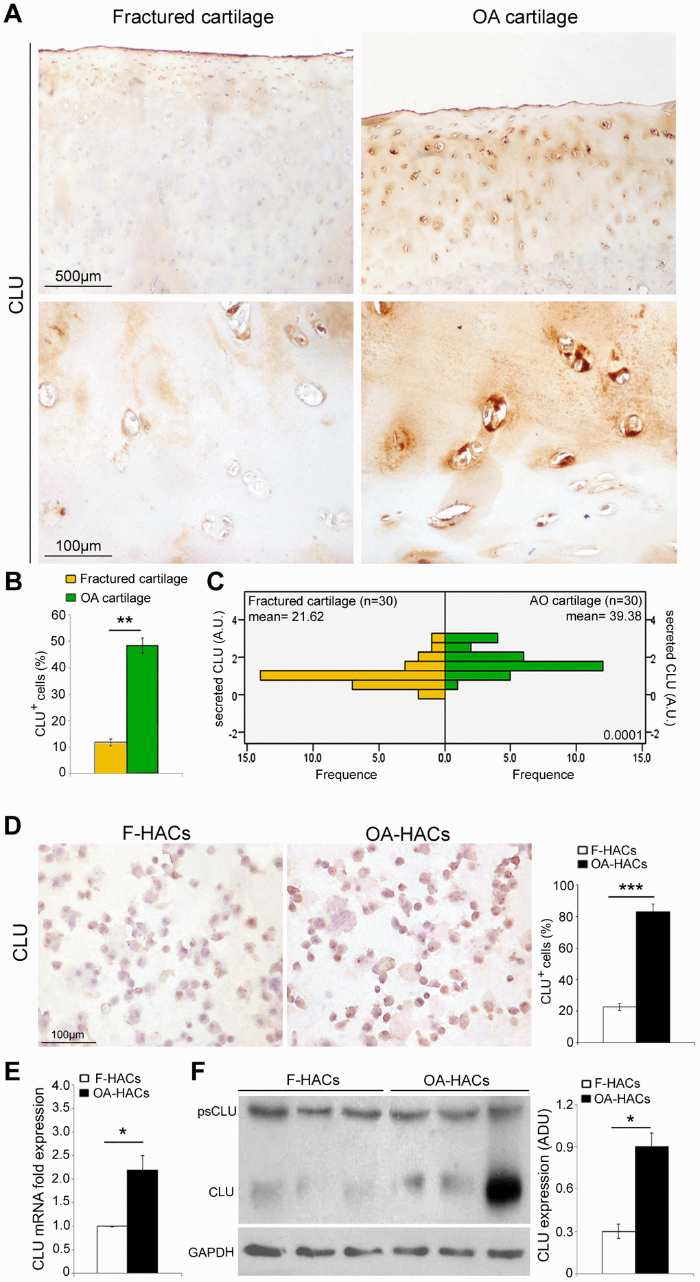 CLU expression in cartilage and chondrocyte cultures of fractured and OA patients. (A) Representative images of CLU immunohistochemistry on femoral cartilage of fractured and OA patients. (B) Percentage of CLU+ cells and (C) extracellular CLU secretion in femoral cartilage of fractured (n=30 donors; yellow bars) and OA patients (n=30 donors; green bars). Student’s t-test: **P P D) Representative images and semi-quantitative evaluation of CLU immunocytochemistry on cytospinned HACs from fractured and OA patients. Data are expressed as mean values ± SEM of three independent experiments (each using pooled samples from n=3 fractured and n=3 OA donors) performed in triplicate. (E) CLU mRNA levels by Real-Time PCR and (F) representative blot and densitometric analysis of CLU protein in cultured HACs from fractured and OA cartilage of individual donors (n=10 fractured and n=10 OA patients). Experiments were performed in triplicate. Data are expressed as mean values ± SEM. Abbreviations: A.U, arbitrary units; F-HACs, fractured patient human articular chondrocytes; OA-HACs, OA-Human articular chondrocytes; psCLU, CLU precursor protein. Student’s t-test: *P P 