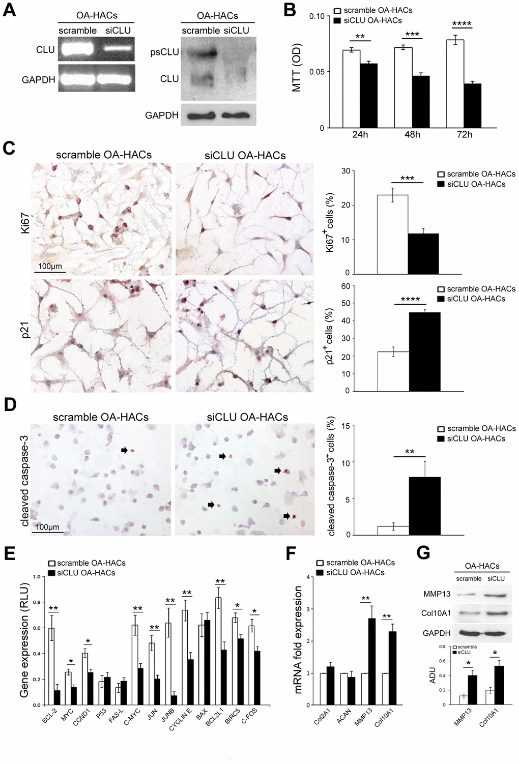 Effects of CLU silencing on viability, proliferation/death and differentiation of cultured OA chondrocytes. (A) CLU mRNA and protein expression after 48 and 72 hours, respectively, in scramble (control) and siCLU transfected OA-HACs. (B) Cell viability by MTT assay after 24, 48 and 72 hours of scramble and siCLU transfected OA-HACs. (C) Representative immunocytochemical images and bar graphs showing Ki67+ and p21+ nuclei in cultured OA-HACs and (D) cleaved caspase-3+ cytospinned OA-HACs after 72 hours of silencing. (E) Gene array shows the modulation of NFkB and Stat-3-related genes in siCLU transfected OA-HACs compared with scramble after 48 hours of silencing. Transcript levels were normalized on GAPDH (internal reference gene). (F) mRNA levels by Real-Time PCR of COL2A1, ACAN, MMP13, COL10A1, and (G) representative blot and densitometric analysis of MMP13 and COL10A1 in scramble and CLU-silenced OA-HACs. Data are expressed as mean values ± SEM of three independent experiments (each using pooled samples from n=3 OA donors) performed in triplicate. Abbreviations: OA-HACs, OA-Human articular chondrocytes; OD, optical density unit; RLU, relative light unit. Student’s t-test: *P P P P 