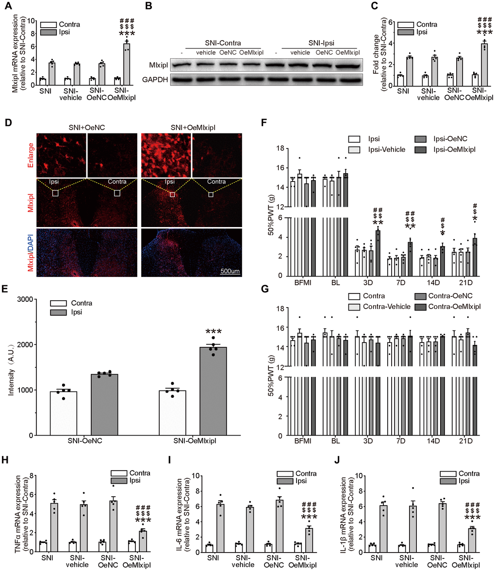 Overexpression of Mlxipl in the SDH inhibited mechanical allodynia and neuroinflammation. (A–E) Mlxipl in the ipsilateral SDH was overexpressed by intraspinal microinjection of OeMLXIPL. SNI surgery was performed on day 28 after intraspinal microinjection. QPCR (A), western blot (B) and immunofluorescence (D) were performed at day 7 after SNI surgery. Quantification of western blot (C) and immunofluorescence (E). N = 5. ***P ###P $$$P F and G) Overexpression of Mlxipl inhibited mechanical allodynia in the ipsilateral paw. The Von Frey test was performed before and after SNI surgery with or without pre-microinjection. N = 5. **P ##P #P $$P $P H–J) Overexpression of Mlxipl inhibited neuroinflammation in the ipsilateral SDH. Proinflammatory cytokines were detected using qPCR at day 7 after SNI surgery. N = 5. ***P ###P $$$P 