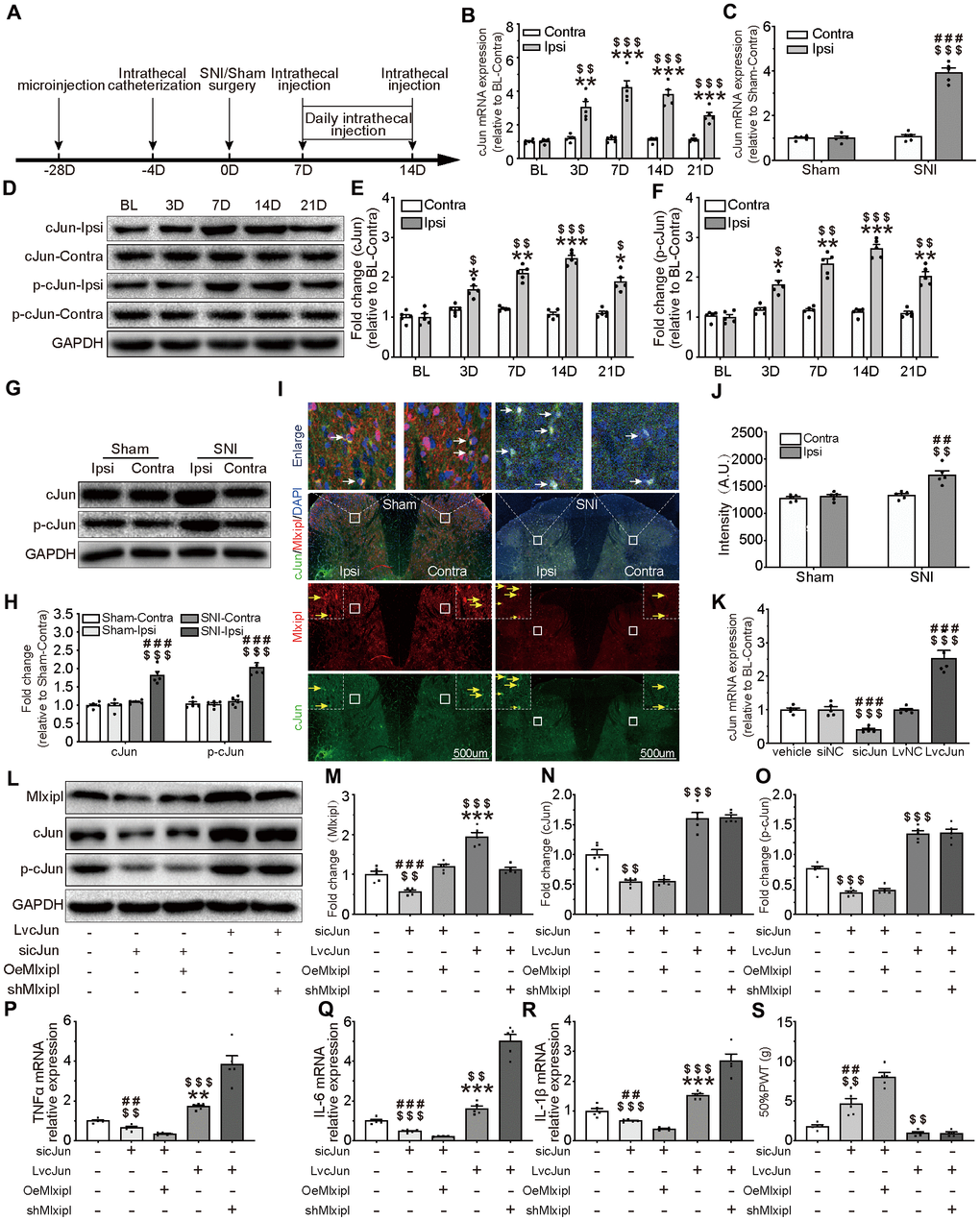 cJun-induced Mlxipl upregulation protectively inhibited inflammation in the SDH and improved mechanical allodynia. (A) The schematic illustrates the timing of the main experimental process. (B and D–F) QPCR (B) and western blot (D) were performed before and after surgery. CJun or p-cJun in the ipsilateral SDH was upregulated after SNI surgery. Quantification of the western blot (E-F). N = 5. ***P $$$P $$P $P C and G–J) QPCR(C), western blot (G) and immunofluorescence (I) were performed at day 7 after Sham or SNI surgery. CJun or p-cJun was significantly upregulated in the ipsilateral SDH. cJun was co-localized with Mlxipl (white arrows). Quantification of the western blot (H) and immunofluorescence (J). N = 5. $$$P $$P ###P ##P K–O) Intrathecal injections of cJun small interfering RNA (sicJun) or lentivirus encoding cJun (LvcJun) were performed at day 7 after SNI surgery. The injections were carried out once a day for 7 consecutive days and then cJun expression was detected by qPCR (K) and western blot (L). Knockdown of cJun inhibited the expression of Mlxipl and p-cJun. Overexpression of cJun promoted the expression of Mlxipl and p-cJun (L-O). Quantification of the western blots (M–O). N = 5. $$$P $$P ###P ##P **P P–S) The effect of cJun on neuroinflammation (P–R) and mechanical allodynia (S), with or without the pre-microinjection of OeMlxipl or shMlxipl. N = 5. $$$P $$P ###P ##P **P 