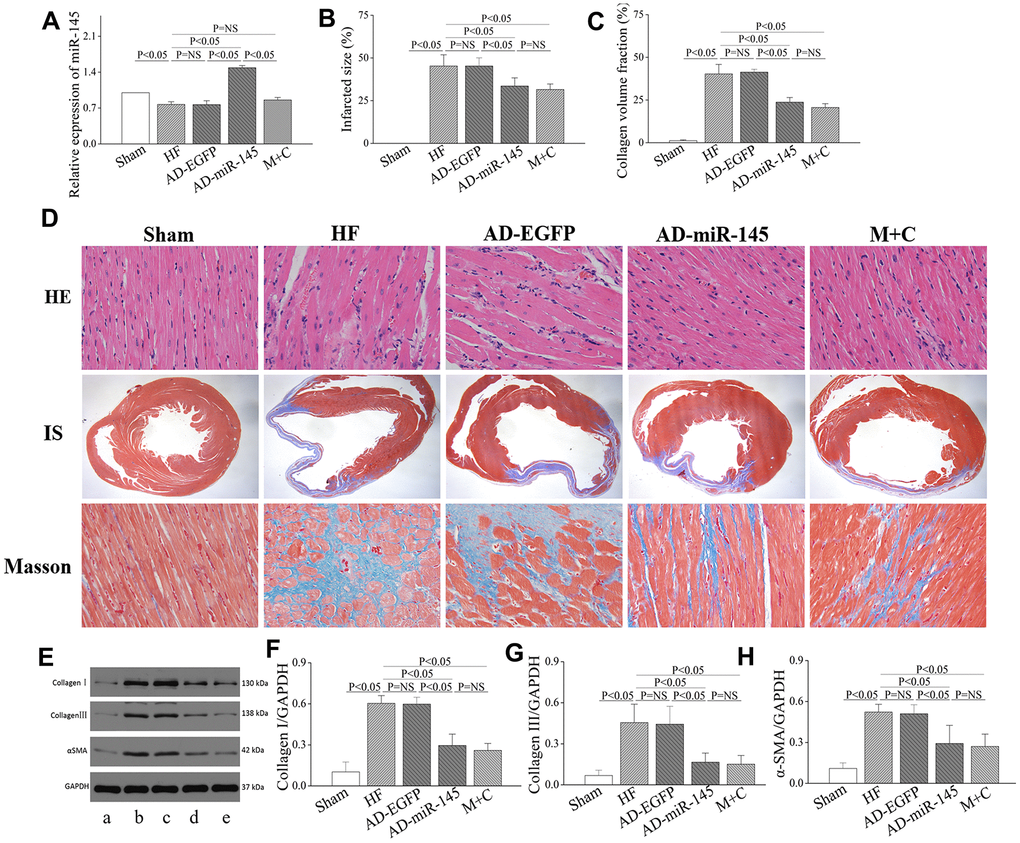 miR-145 attenuated structural remodeling after HF. (A) relative expression of miR-145 (n=3); (B) quantification of infarcted size (n=5); (C) statistical results of LV fibrosis (n=5); (D) representative imagine of HE and masson’s stain; (E) representative western blots; (F–H) quantitative analysis of the immunoreactive band displayed by bar graph (n=3). (a) sham group; (B) HF group; (C) AD-EGFP; (D) AD-miR-145 group; (E) M+C group; IS, infarcted size. Data are presented as mean ± SD.