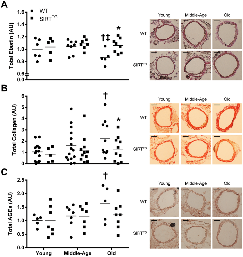 Total thoracic aortic elastin (A), collagen (B), and advanced glycation end products (C [AGEs]) content in young, middle-age, and old wild-type (WT) and SIRT-1 transgenic overexpressing (SIRTTG) mice. Figures are accompanied by representative images of elastin, collagen, and AGEs staining. Black scale bars are equal to 200 μm. *P†P‡P