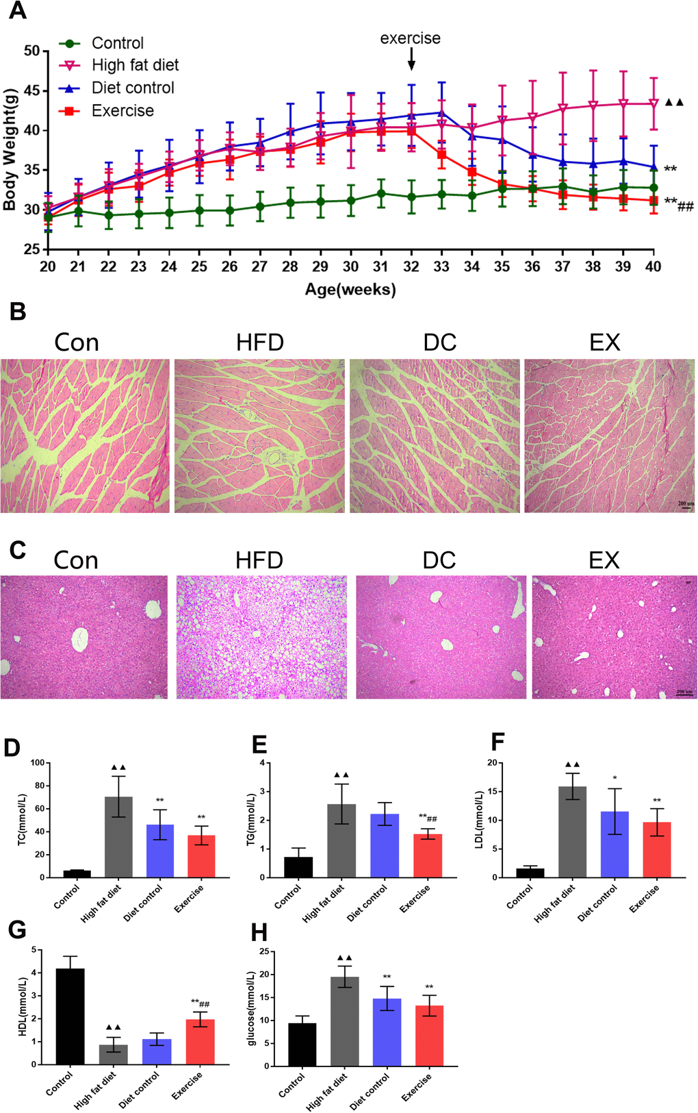 Swimming exercise and diet control improved physiological conditions. (A) The changes in body weight of mice at 20-40 weeks of age, respectively. There was no difference in body weight among groups at 32 weeks of age. It was significantly different in the body weight at the end of the intervention (40 weeks) among groups, EX group had the lowest body weight (p B) HE staining of mouse gastrocnemius muscle. Scale bar = 200μm. (C) HE staining of mouse liver tissue. Scale bar = 200μm. (D–H) Serum TC, TG, LDL, HDL and glucose levels. vs control group, ▲▲p p p #p ##p 