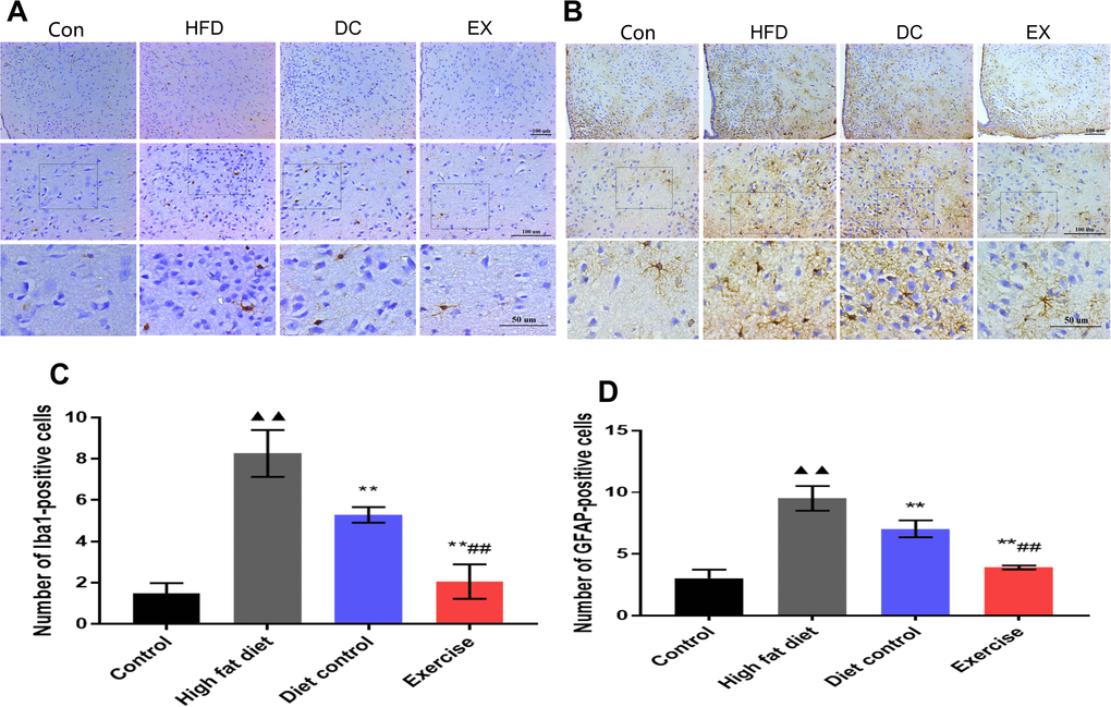 The activation of microglia and astrocytes in the hypothalamus. (A) Iba1 expression levels in hypothalamic microglia. The statistics analysis of the expression of Iba1 positive cells. (B) The expression levels of GFAP in hypothalamic astrocytes. (C) The statistics analysis of the expression of Iba1 positive cells. (D) The statistics analysis of the expression of GFAP positive cells. The scale bar is shown in the figure. vs control group, ▲▲p p ##p 