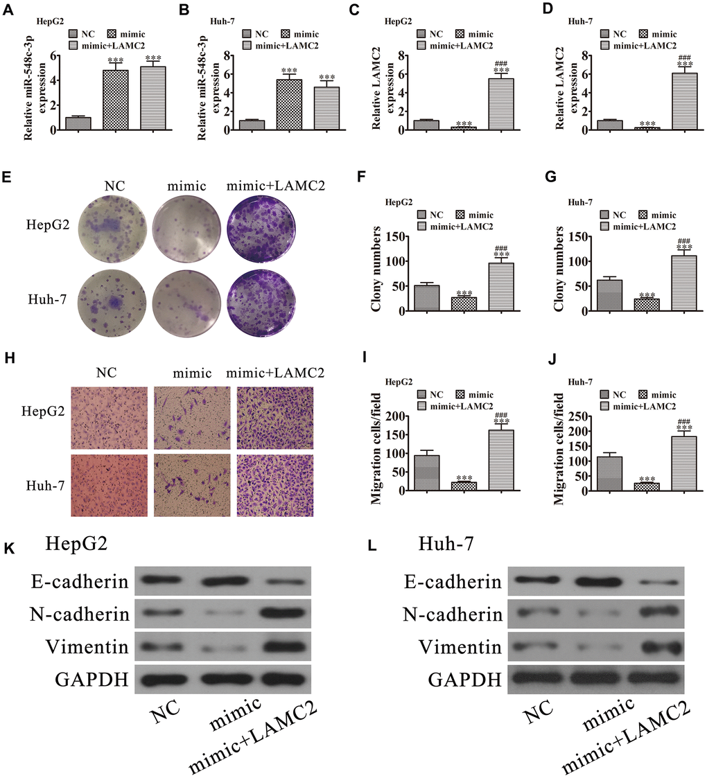 LAMC2 overexpression reversed miR-548c-3p-induced cell migration and growth inhibition in vitro. HepG2 and Huh-7 cells were transfected with miR-548c-3p mimics with or without the LAMC2 overexpression vector. (A and B) RT-qPCR assay showing the expression of miR-548c-3p (A and B) and LAMC2 (C and D) in HepG2 and Huh-7 cells. Data are mean ± SD. ***P ###P E–G) Colony formation assay showing the proliferation of HepG2 and Huh-7 cells. Data are mean ± SD. ***P ###P H–J) Cell migration were assessed in HepG2 and Huh-7 cells by Transwell assays. Data are mean ± SD. ***P ###P K and L) Western blot analysis of the expression of E-cadherin, N-cadherin, and vimentin. Data are mean ± SD. ***P ###P 