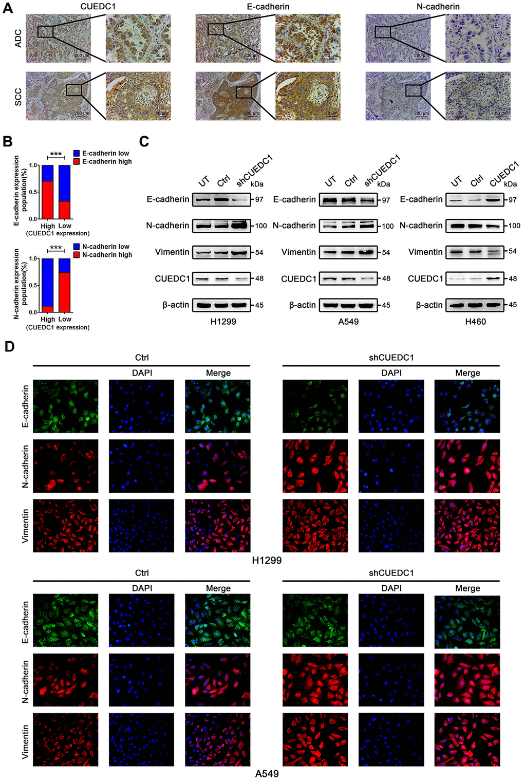 CUEDC1 expression was negatively correlated with EMT process in NSCLC tumor tissues and cell lines. (A) IHC detected the expression of CUEDC1, E-cadherin, N-cadherin in lung adenocarcinoma and lung squamous cell carcinoma tissues (magnification, ×100 and ×400). (B) A significant correlation between CUEDC1 expression and E-cadherin expression (upper panel), N-cadherin expression (lower panel) in NSCLC tissues. P values were calculated using the χ2 test. (C) The expression of EMT markers in CUEDC1-shRNA cells and control cells of H1299 and A549 cell lines. The expression of EMT markers in H460-CUEDC1 cells and control cells. (D) The protein levels and localization of EMT markers were observed by immunofluorescence in H1299 cells and A549 cells. Representative fluorescein immunocytochemical staining is depicted with E-cadherin (green), N-cadherin (red), Vimentin (red), and nuclear DAPI (blue). Experiments were performed at least three times. The data are expressed as the mean ± SEM; *P P P 