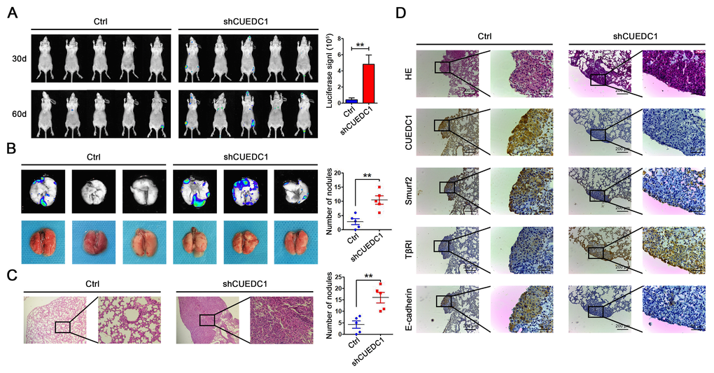 CUEDC1 inhibited the metastasis of NSCLC in vivo. (A) A total of 1×106 of CUEDC1-knockdown or control cells were injected into tail vein of nude mice. After injection, bioluminescence images were monitored at the indicated time points. The number of metastatic sites is shown as the mean ± SEM; n=5 mice per group, P values were calculated using Student’s t-test. (B) The lungs were removed eight weeks later. Bioluminescence images and representative lung images of lung metastatic nodules are shown distinctly, and the numbers of metastatic nodules were measured. The data were statistically analysed by t-test and show the mean ± SEM. (C) Microscopic images of lung tissue sections stained by hematoxylin and eosin. The number of nodules on the lungs of nude mice was quantified (n=5 per group). Statistical analysis was performed using Student’s t-test. (D) CUEDC1, Smurf2, TβRI and E-cadherin expression were tested by immunohistochemical staining in lung tissues of mice (magnification, ×100 and ×400). The data are expressed as the mean ± SEM; *P P P 