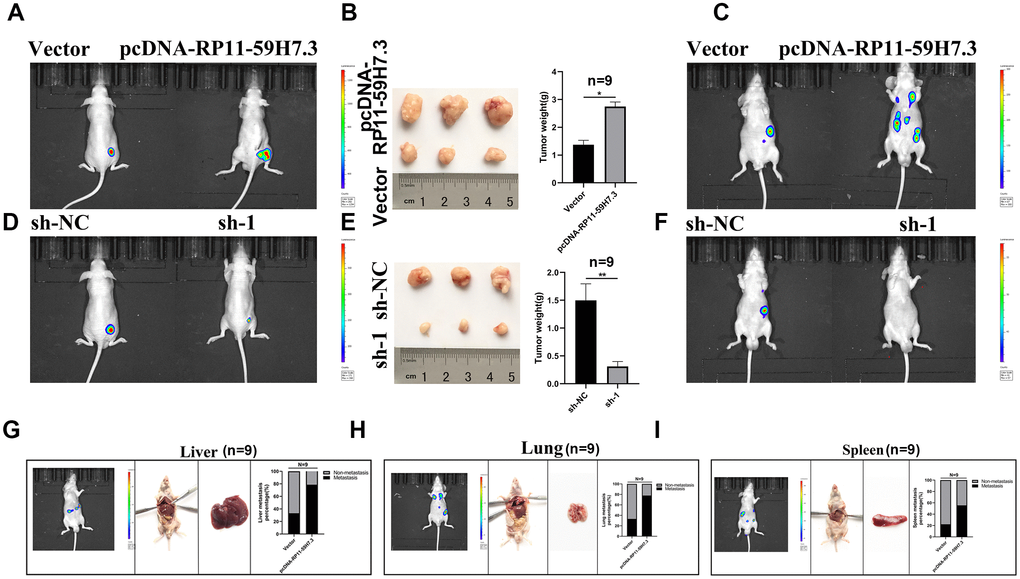 The lncRNA RP11-59H7.3 deregulation inhibits cell invasion and proliferation in CRC orthotopic xenografts. (A–C) representative IVIS images showing size of tumors (A), macroscopic appearance (B), and metastasis (C) in sh-lncRNA RP11-59H7.3 groups vs control groups. (D–F) Representative IVIS images showing tumor size (D), macroscopic appearance (E), and metastasis (F) in pcDNA-RP11-59H7.3 groups vs control groups. (G–I) Representative macroscopic appearance and IVIS image of metastatic foci (white arrows) in the liver (G), lung (H), and spleen (I). **p p 