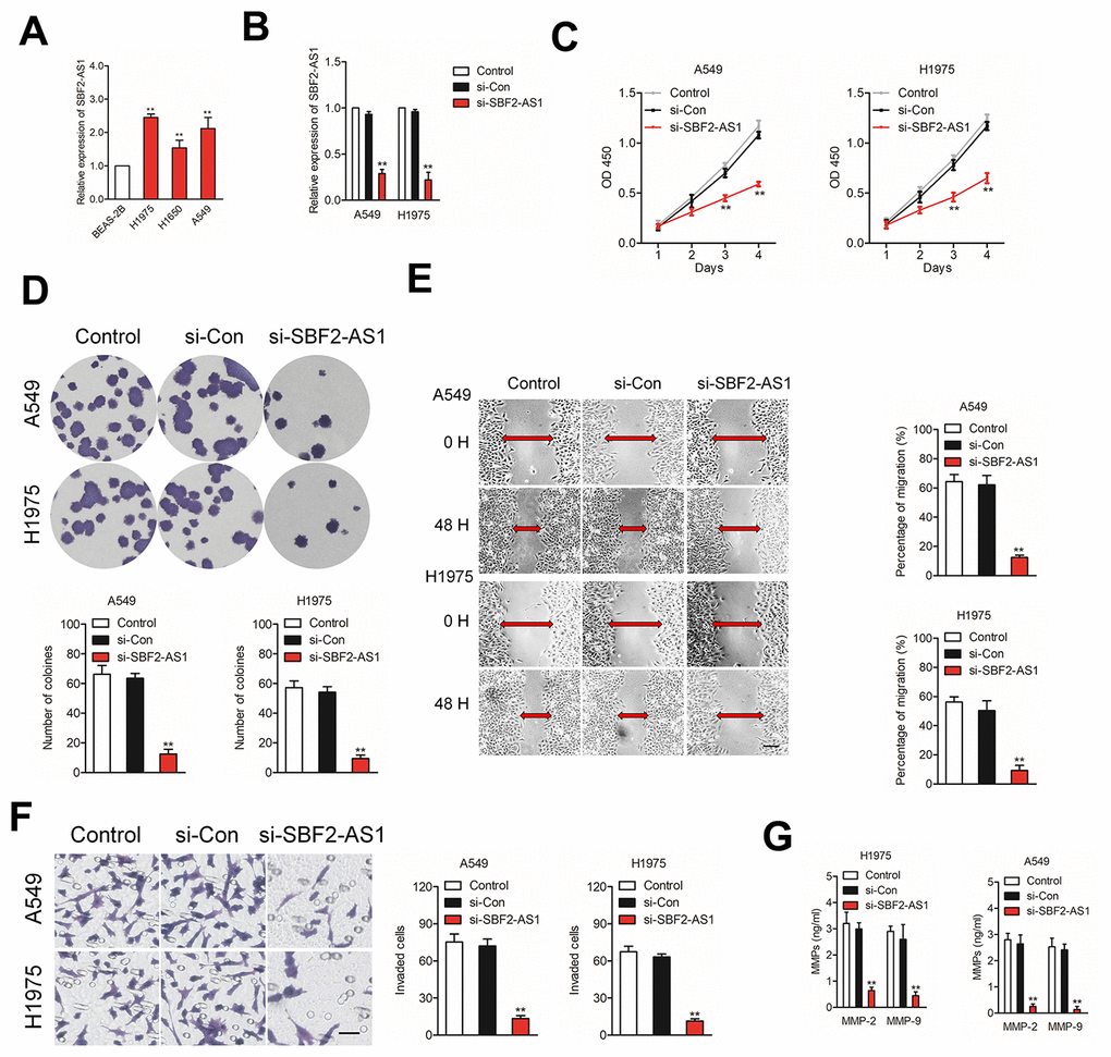 Knockdown of SBF2-AS1 suppresses NSCLC cell proliferation, migration and invasion. (A) qRT-PCR analysis of SBF2-AS1 expression in BEAS-2B and NSCLC cell lines (H1650, A549 and H1975). **PB) qRT-PCR analysis of SBF2-AS1 expression in A549 or H1975 cell transfected with si-Con or si-SBF2-AS1. (C) Cell proliferation capacity was analyzed by CCK-8 assay. (D) Cell proliferation capacity was analyzed by colony formation assay. (E) The migration capability of A549 or H1975 cell transfected with si-Con or si-SBF2-AS1 was analyzed by wound-healing assay. (F) The invasion capability of A549 or H1975 cell transfected with si-Con or si-SBF2-AS1 was analyzed by Transwell assay. (G) The expression of si-SBF2-AS1 in A549 and H1975 cell decreased secreted MMP-2/9 protein levels, as shown by ELISA. The data are presented as the mean ± SD. All in vitro data are representative of three independent experiments. **P