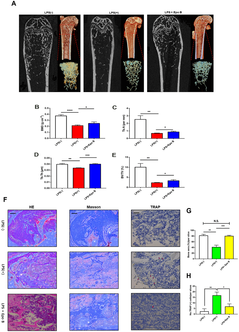 Epothilone B prevented LPS-induced inflammatory osteolysis in vivo. (A) Representative μCT longitudinal section images of the femurs, cross-sectional view of the distal femurs and reconstructed trabecular structure of the ROI (red dashed box). (B–E) Quantitative μCT analysis of distal femoral volumetric bone mineral density (BMD), BV/TV, trabecular thickness (Tb.Th) and trabecular number (Tb.N) in each group. (F) Representative images of histological slides of HE stain, Masson stain and immunohistological stain for TRAP focusing on the metaphyseal region of the distal femur from mice of different groups. Scale bar = 800 μm (G) Quantitative analysis of the percentage of bone area in each slice which was reflected by HE staining. (H) Quantitative analysis of the number of TRAP positive cells in each slice which was reflected by immunohistological stain for TRAP. Data in the figures represent mean ± SD. *p 