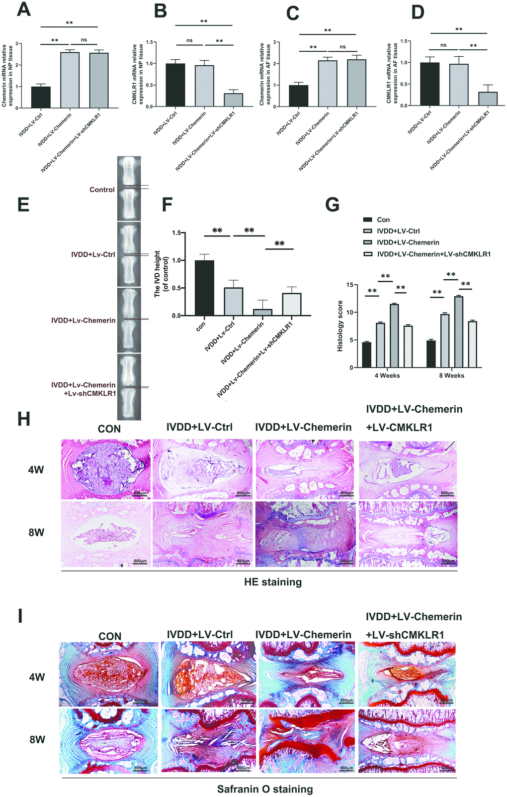 Chemerin aggravates the progression of IVDD in rat’s annulus needle puncture model partly through its receptor CMKLR1. (A–D) RT-PCR results showed that lentivirus-mediated target genes change in NPCs, and AF tissue were successful at 10 days after the lenti-virus injection. (E) X-ray of a rat tail with a needle-punctured disc at 8 weeks post-surgery. (F) The disc height index (DHI) was determined in four groups at 8 weeks. (G) The histopathological scores were evaluated at 4- and 8-weeks post-surgery in four groups. (H) Representative SO staining of punctured disc in different group (original magnification ×40, scale bar: 100 μm). Three sections were randomly selected for quantification, with a representative example shown. (I) Representative HE staining of punctured disc in different group (original magnification ×40, scale bar: 100 μm). Data are represented as mean ± SEM. Significant differences between groups are indicated as **p 