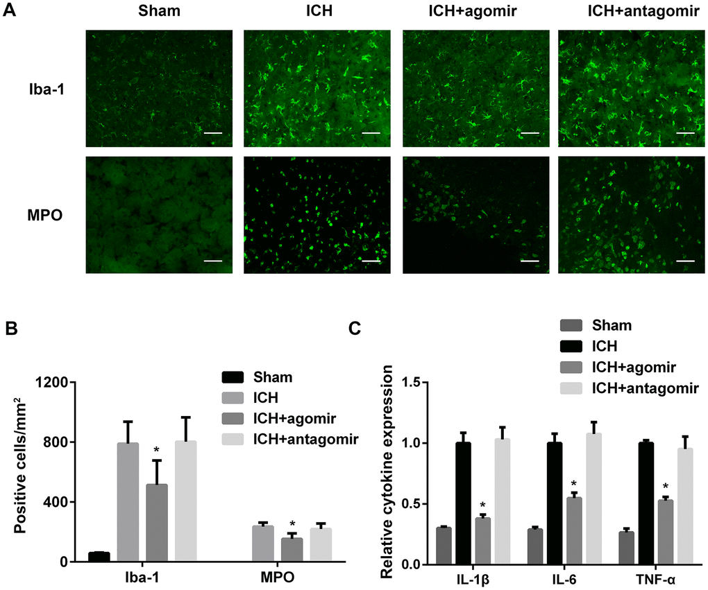 Treatment with miR-183-5p alleviated early inflammation after intracerebral hemorrhage (ICH). (A) Representative immunofluorescence images of Iba-1–positive microglia and myeloperoxidase (MPO)-positive neutrophils in different groups at 3 days after ICH. n = 8/group. (B) Quantitative analysis of Iba-1– or MPO-positive cells in (A). Scale bars = 50 μm. (C) Quantitative analysis of cytokine expression in the brains of mice from different groups at 3 days after ICH. n = 8/group. Values are presented as the mean ± standard deviation. *P 